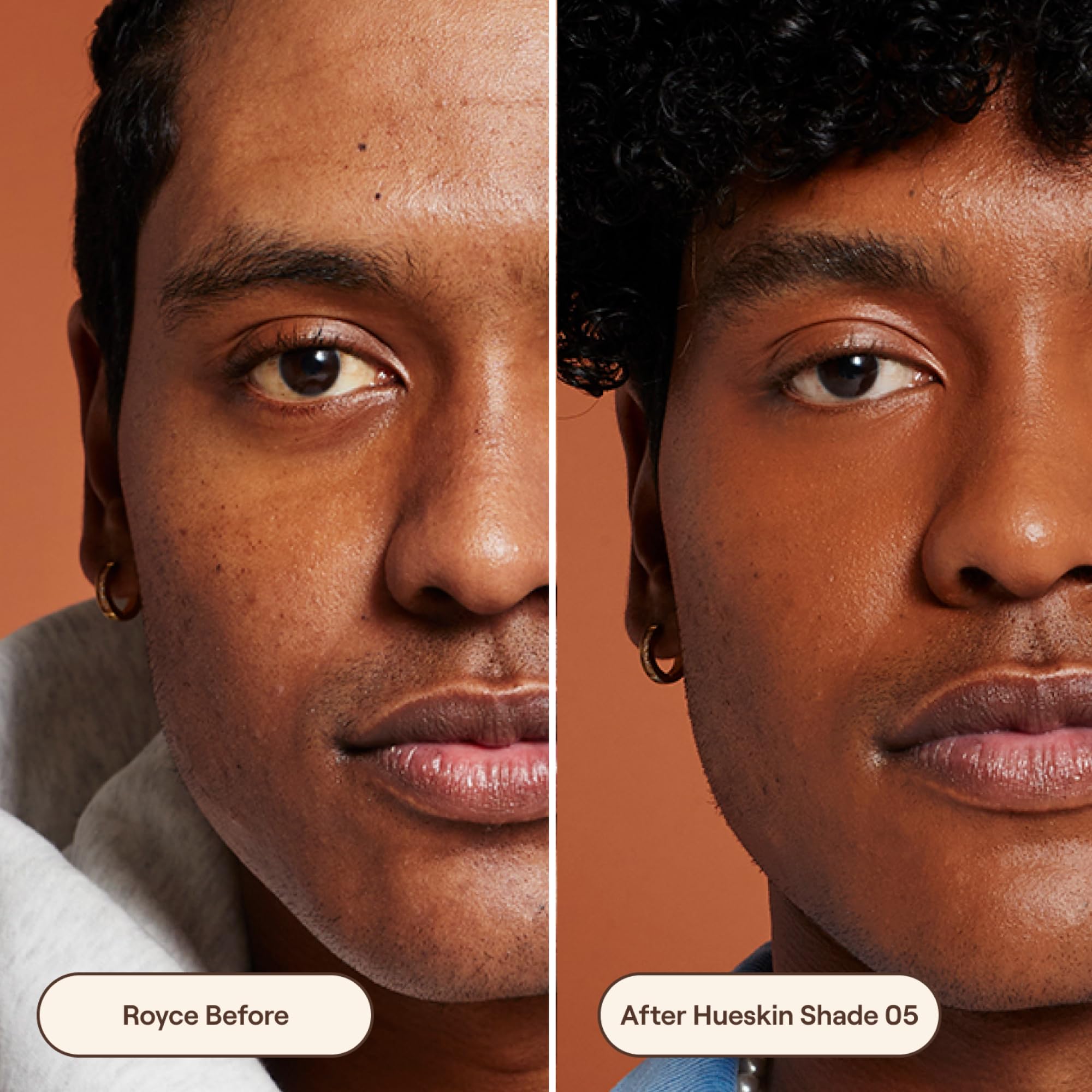 Live Tinted Hueskin Serum Concealer – Medium-to-Full Coverage with Niacinamide & Hyaluronic Acid, Shade 5