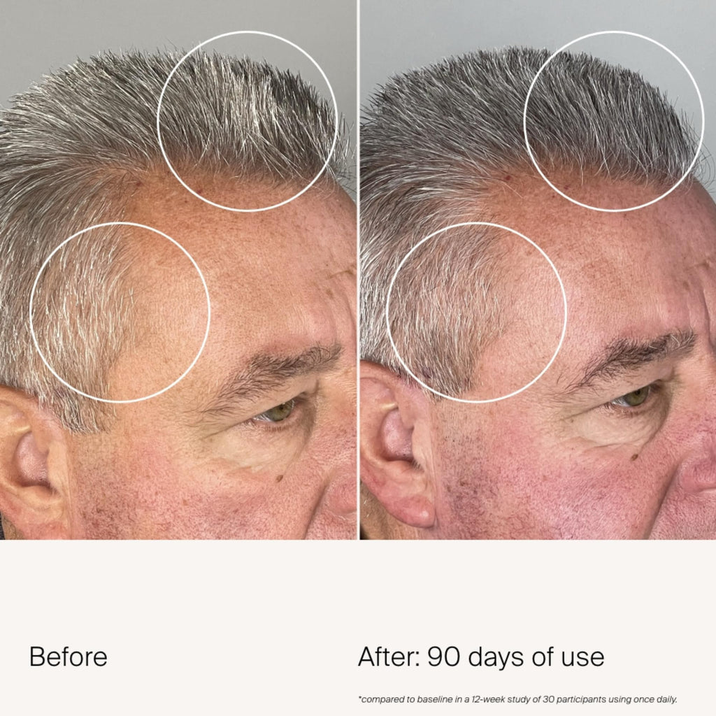 Living Proof Scalp Care Density Serum | Minimize Grey Hair, Boost Density