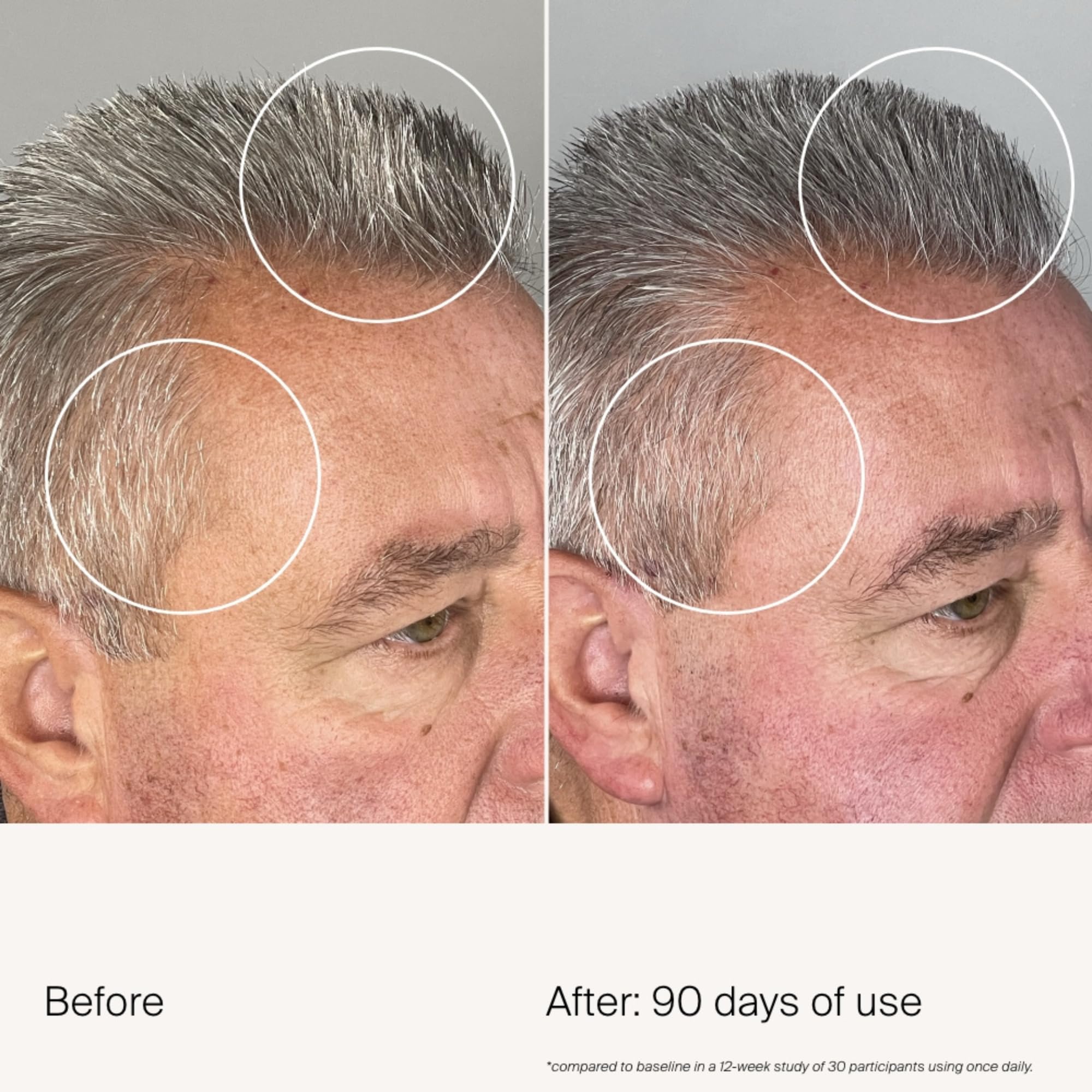 Living Proof Scalp Care Density Serum | Minimize Grey Hair, Boost Density