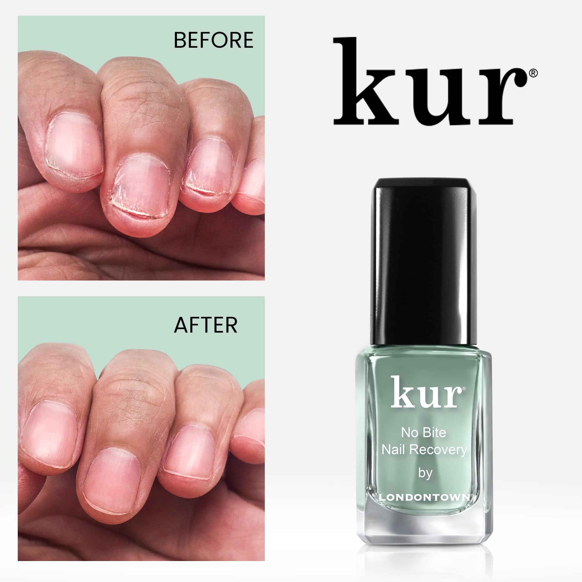 LONDONTOWN No Bite Nail Recovery – Bitter Deterrent Polish for Nail Biting Prevention