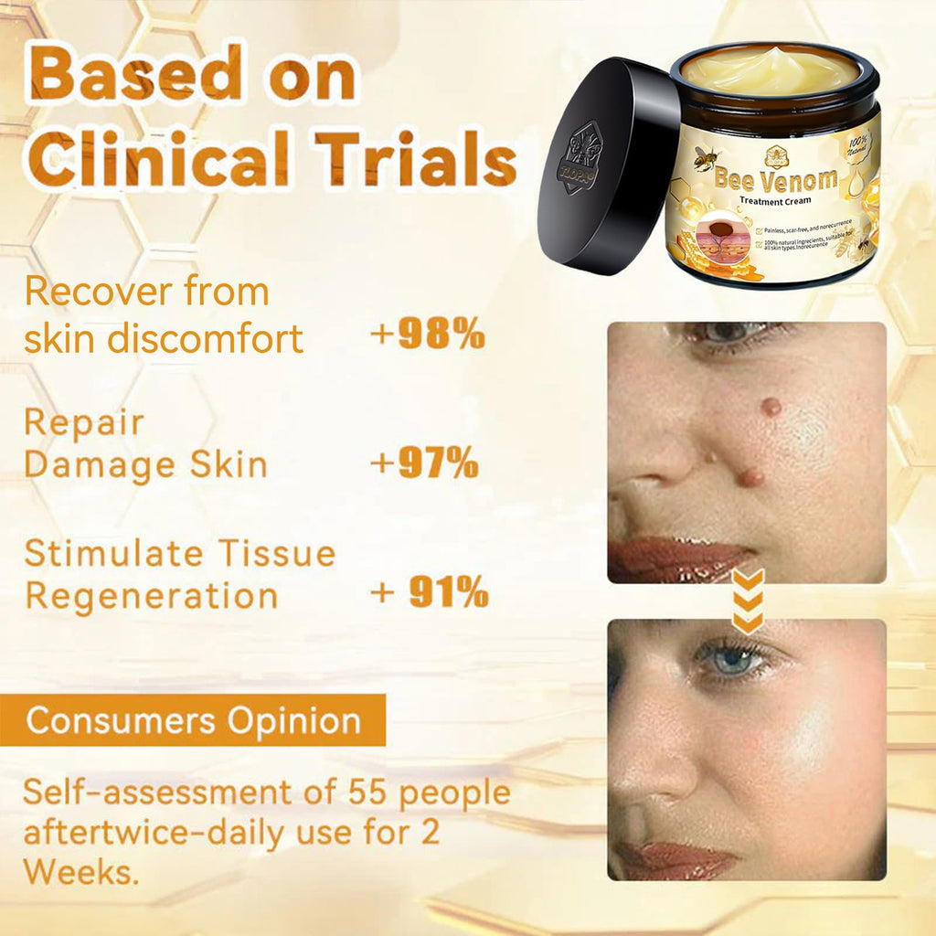Luhaka Bee Venom Skin Cream – Deep Moisturizing Treatment for Blemish-Prone Skin