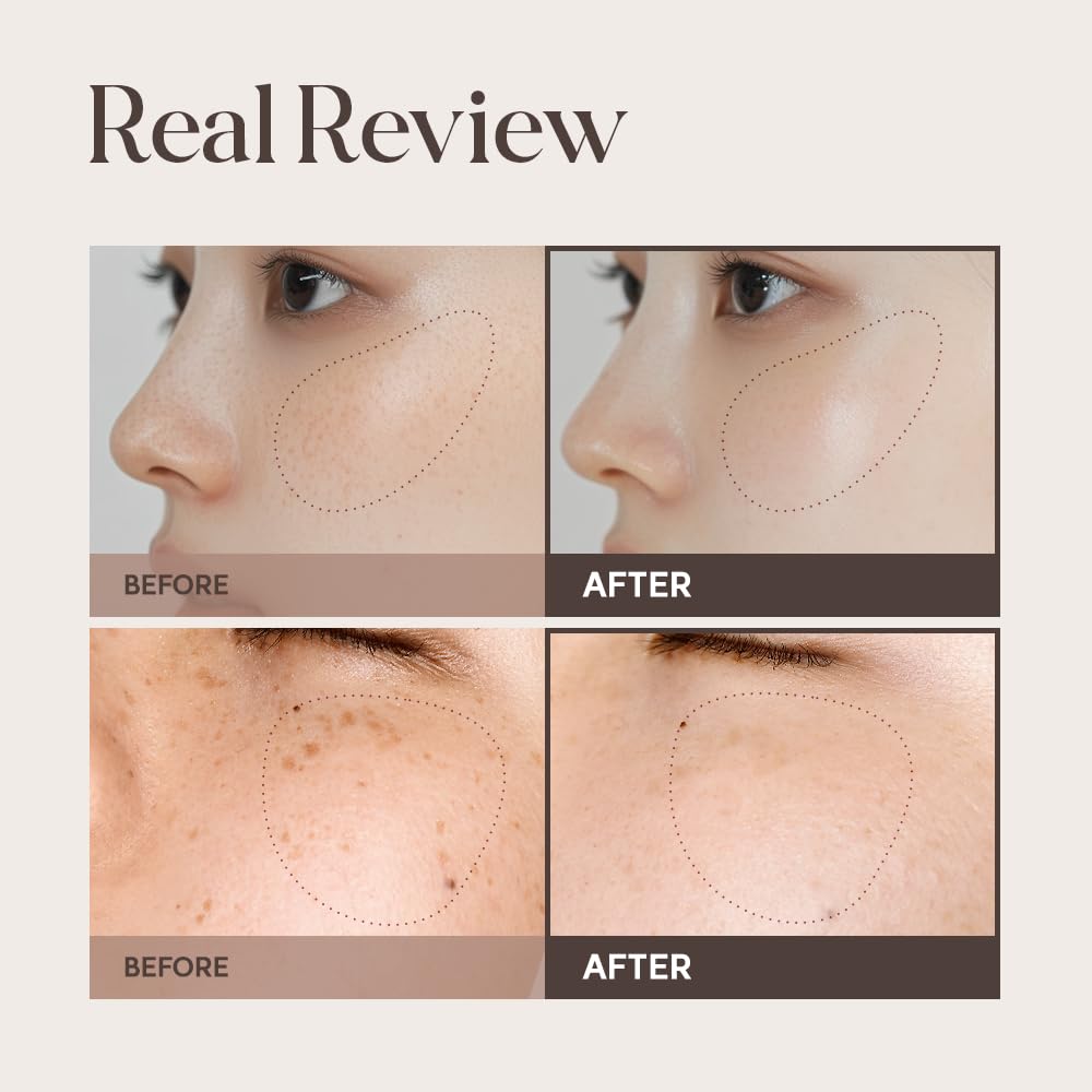 Lulubeu NKCELL Mela Clinic Ampoule – Even Skin Tone Serum with Tranexamic Acid