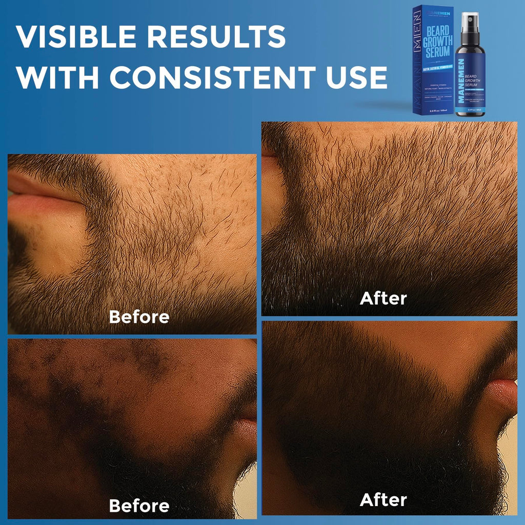 MANEMEN Beard Growth Serum Spray - Biotin, Castor Oil & Vitamins B5/B12