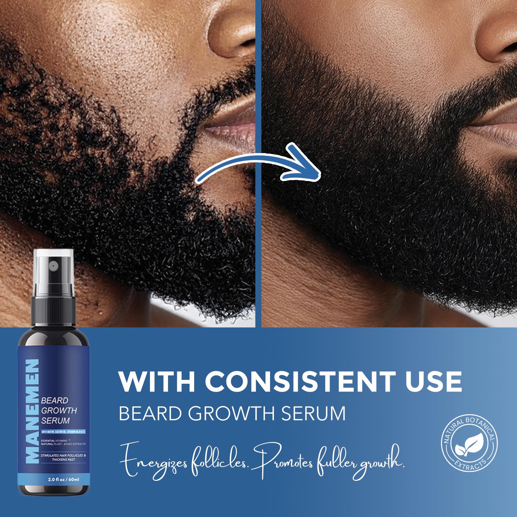 MANEMEN Beard Growth Serum Spray - Biotin, Castor Oil & Vitamins B5/B12