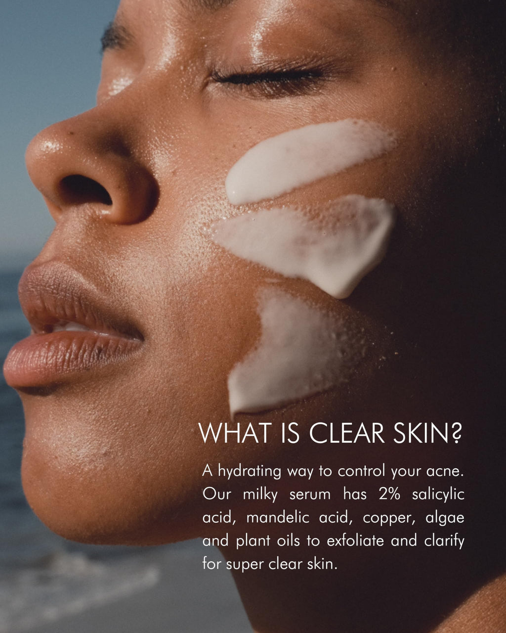 MARA Clear Skin Mineral Milk Hydrating Acne Treatment with Niacinamide + Copper | BHA Serum for All Skin Types (1 oz / 30 ml)
