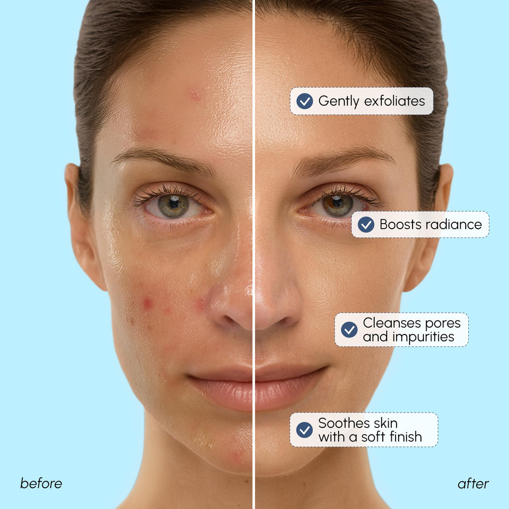 MAREE Face Exfoliator - Gentle Microdermabrasion Scrub with Collagen & Glycolic