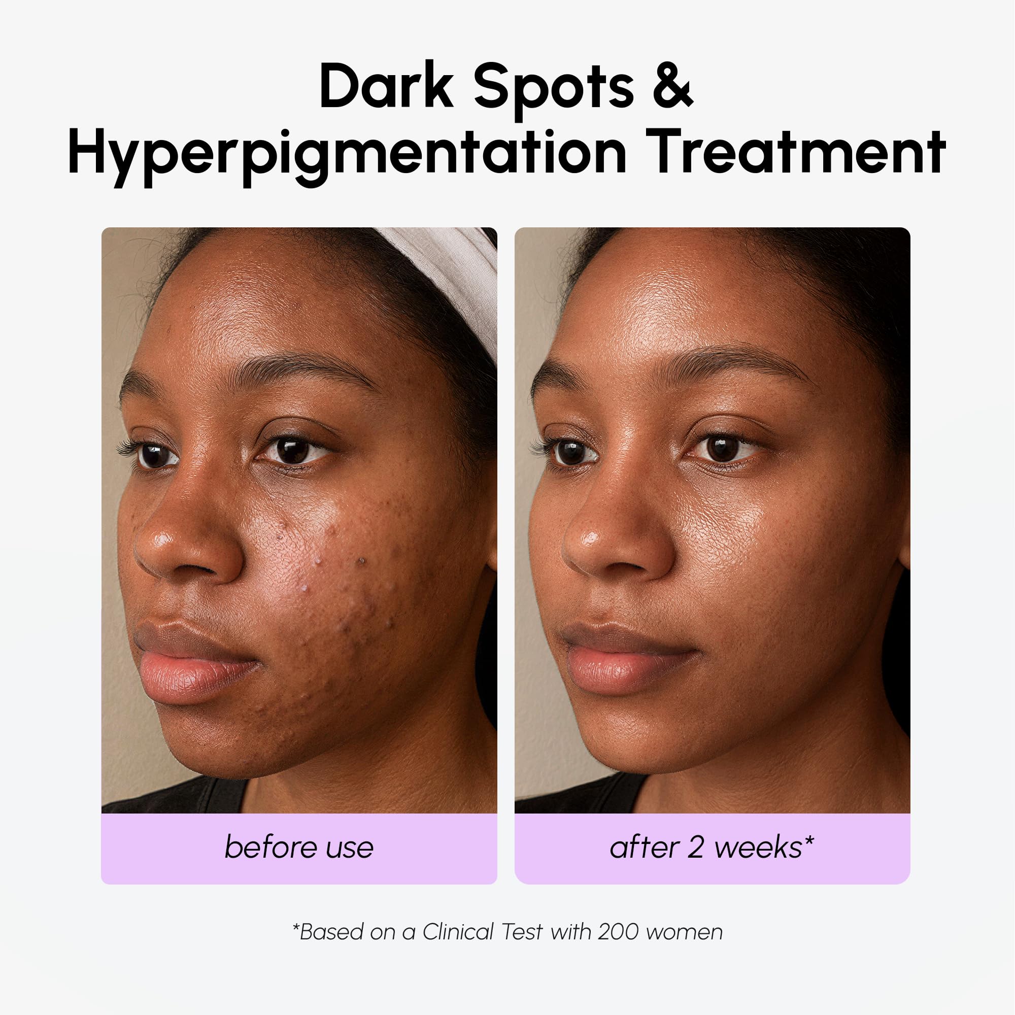 MAREE 20% Tranexamic Acid Serum Complex – Dark Spot Corrector with Niacinamide & Vitamin C