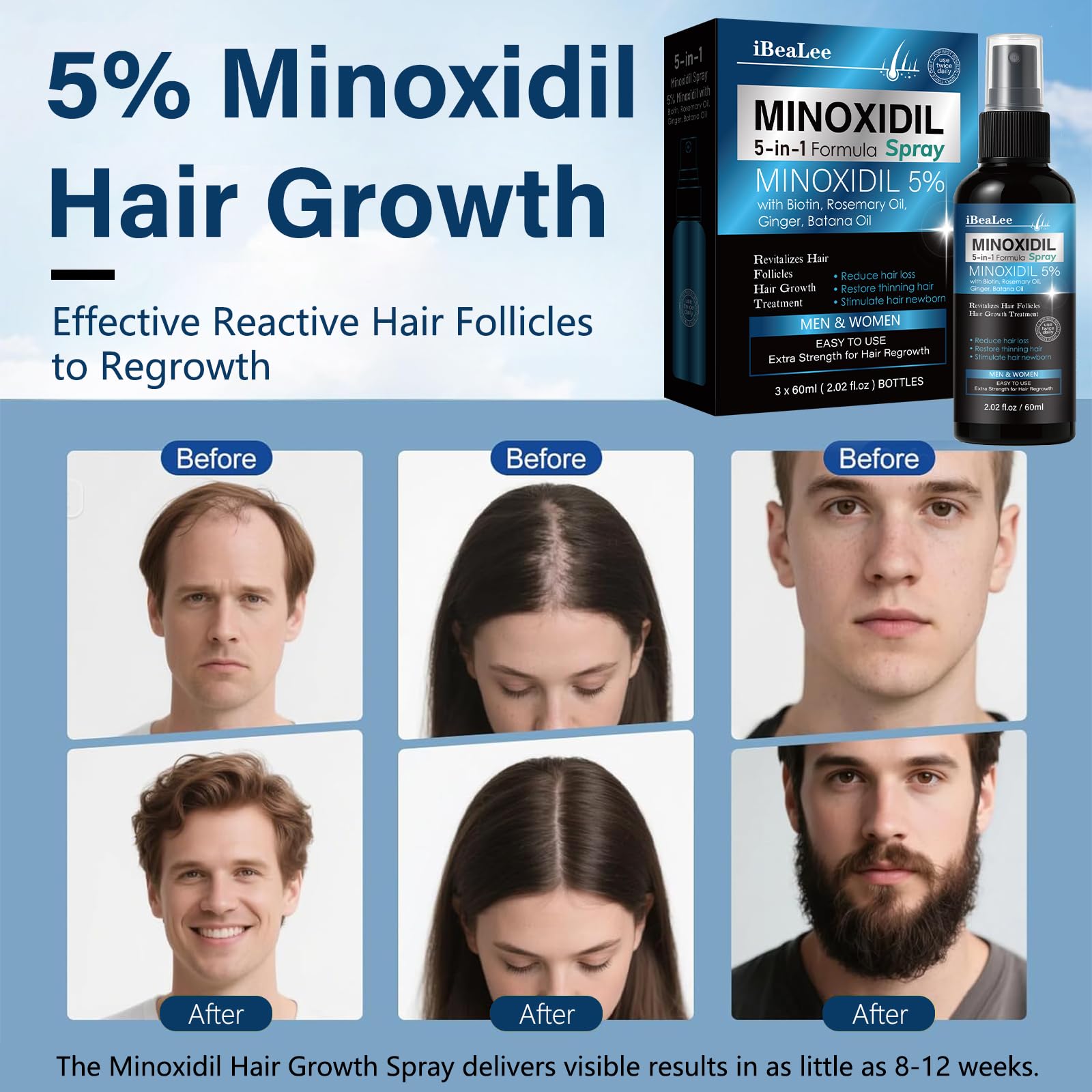 MAYFERTE 5% Minoxidil Hair Growth Spray for Men & Women – Biotin, Rosemary & Batana, 3 Bottles