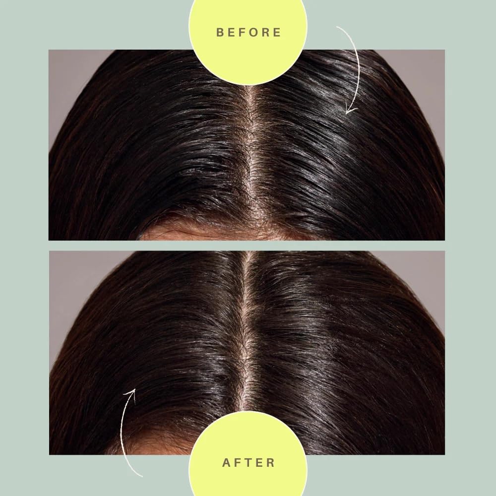 m'chel Day After Brush Dry Shampoo - Patented Applicator, Fragrance-Free, Deodorizes & Removes Oil