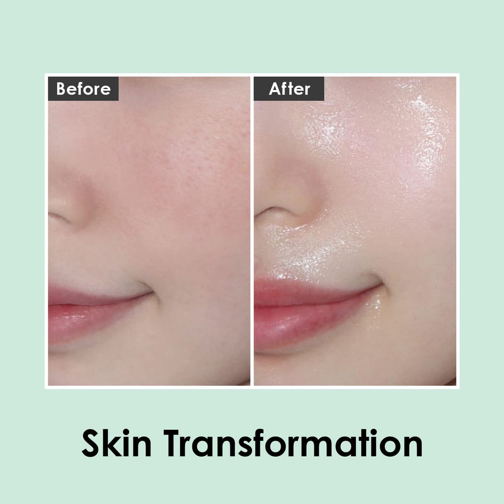 MEDI-PEEL Peptide 9 Volume White Cica Essence – Bubble Texture Brightening Serum for All Skin Types | Korean Skincare