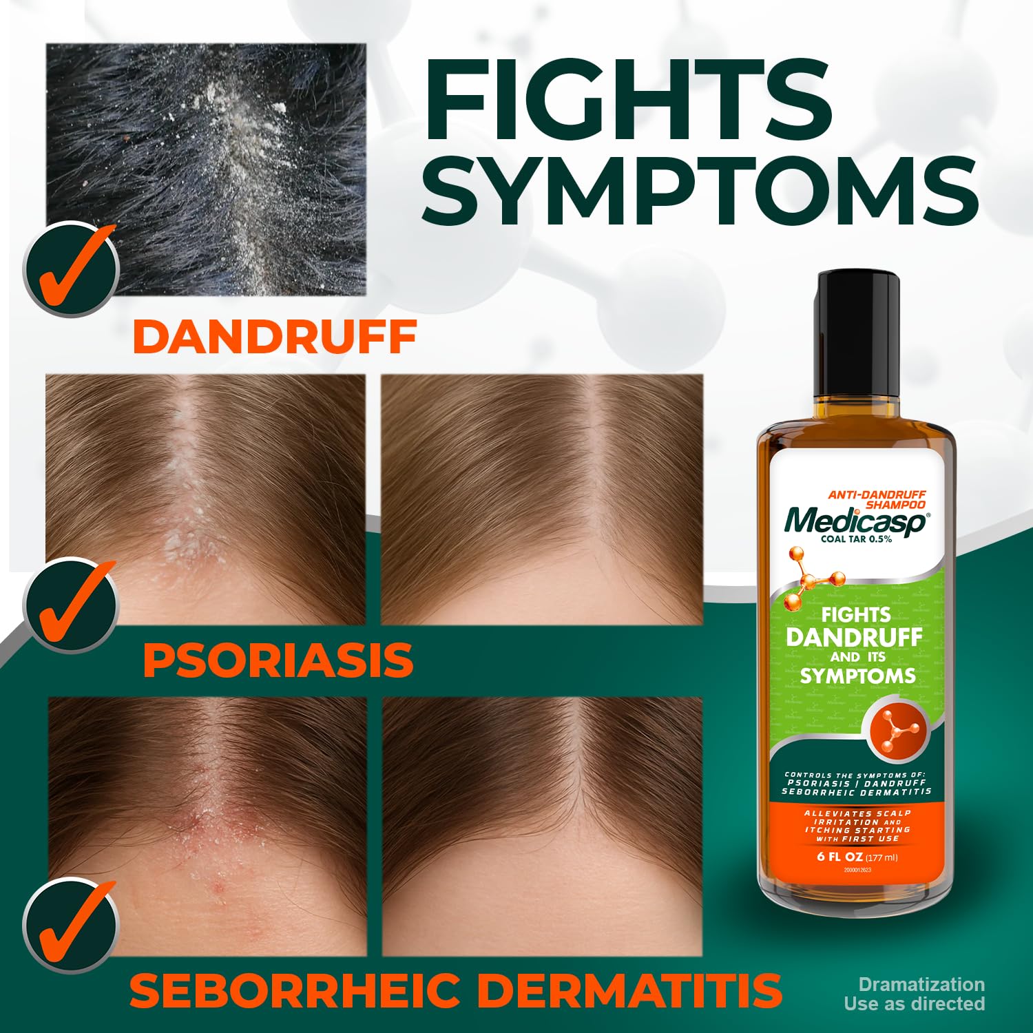 Medicasp Coal Tar Anti-Dandruff Shampoo – Starts Working From First Wash, 2-Pack (6 oz each)