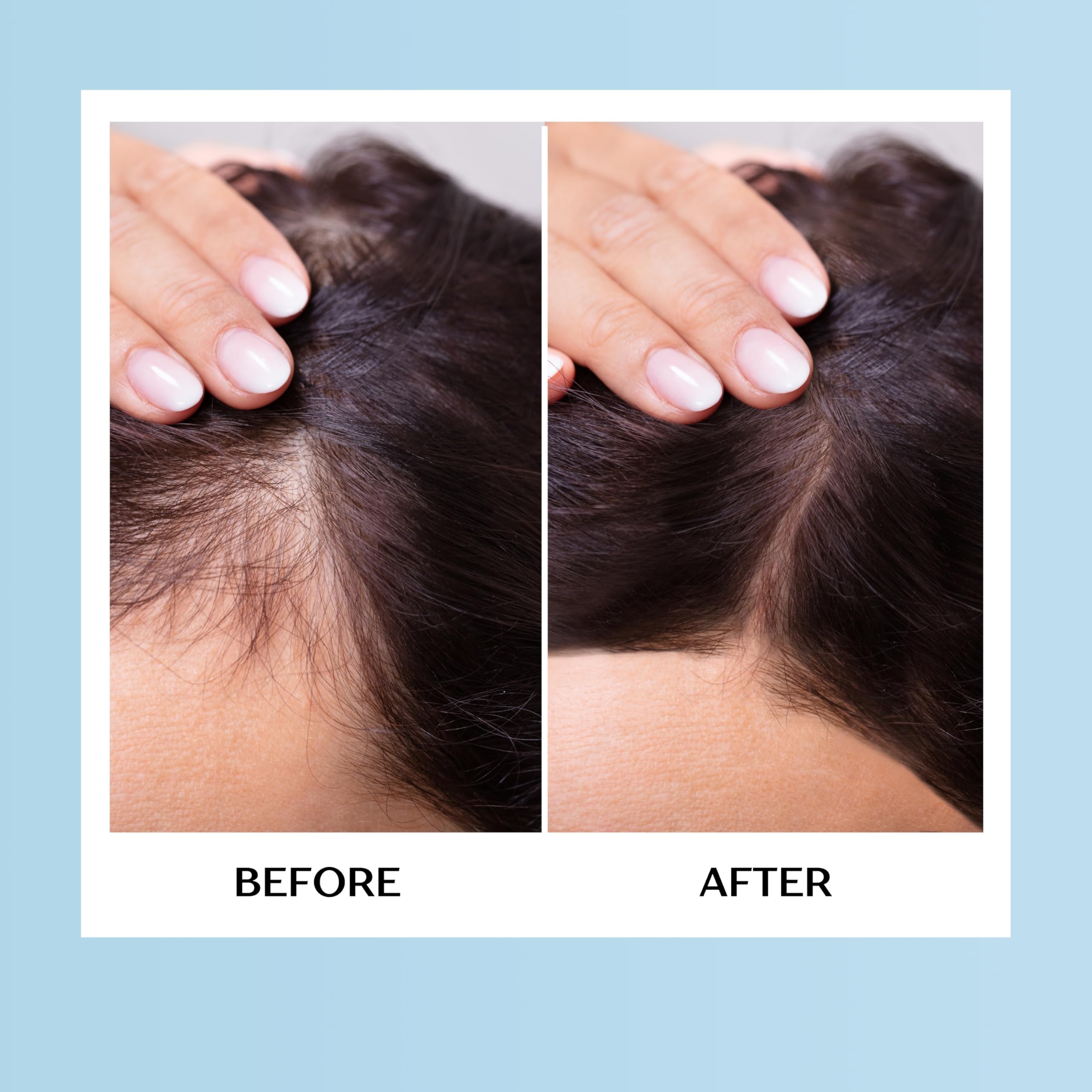 Mediceuticals Therapro HairGain: Natural Phytoflavone DHT-Inhibiting Complex for Hair Health (60 Tablets)