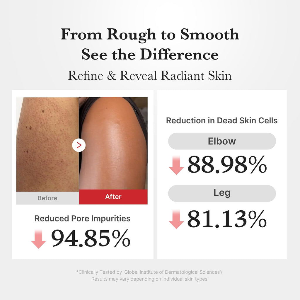 Medicube Body Peel Shot with Hypochlorous Acid | Gentle Body Exfoliating Serum for Dead Skin & Texture | Rice Extract & Panthenol | 9.46 fl oz