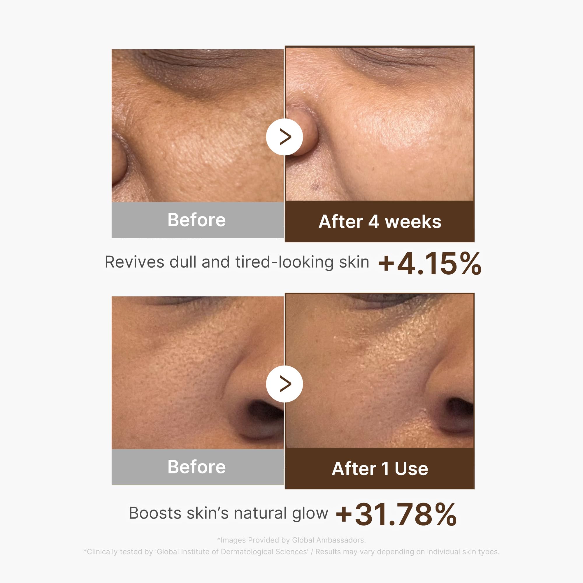 Medicube Deep Vitamin C Capsule Serum | Hydrating Vitamin C Serum for Dull & Uneven Skin | Liposome Capsule Technology | Korean Skincare 1.01 fl oz