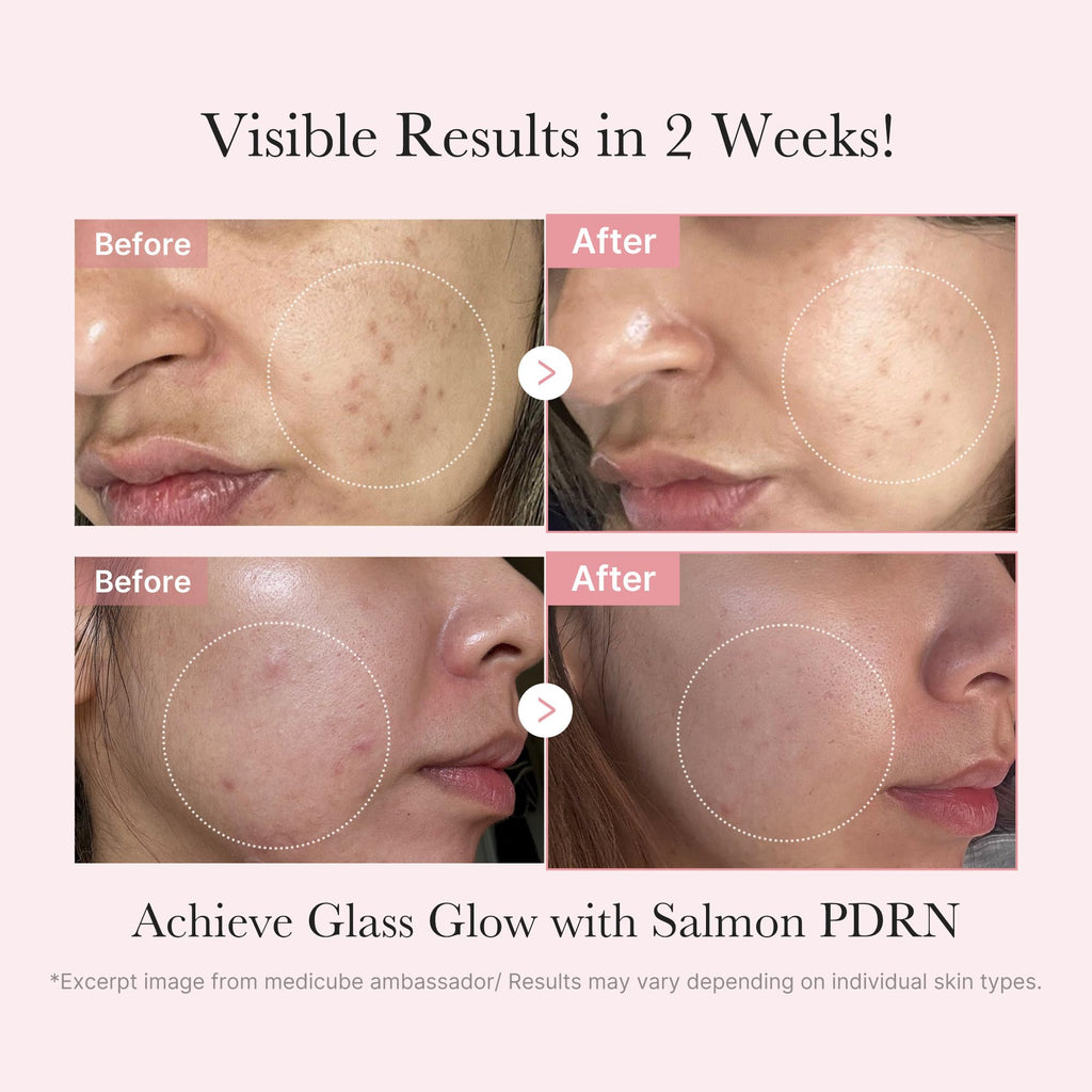 Medicube Salmon DNA PDRN Trial Kit – Glass Glow Mini Skincare Set with Toner, Serum & Sheet Mask