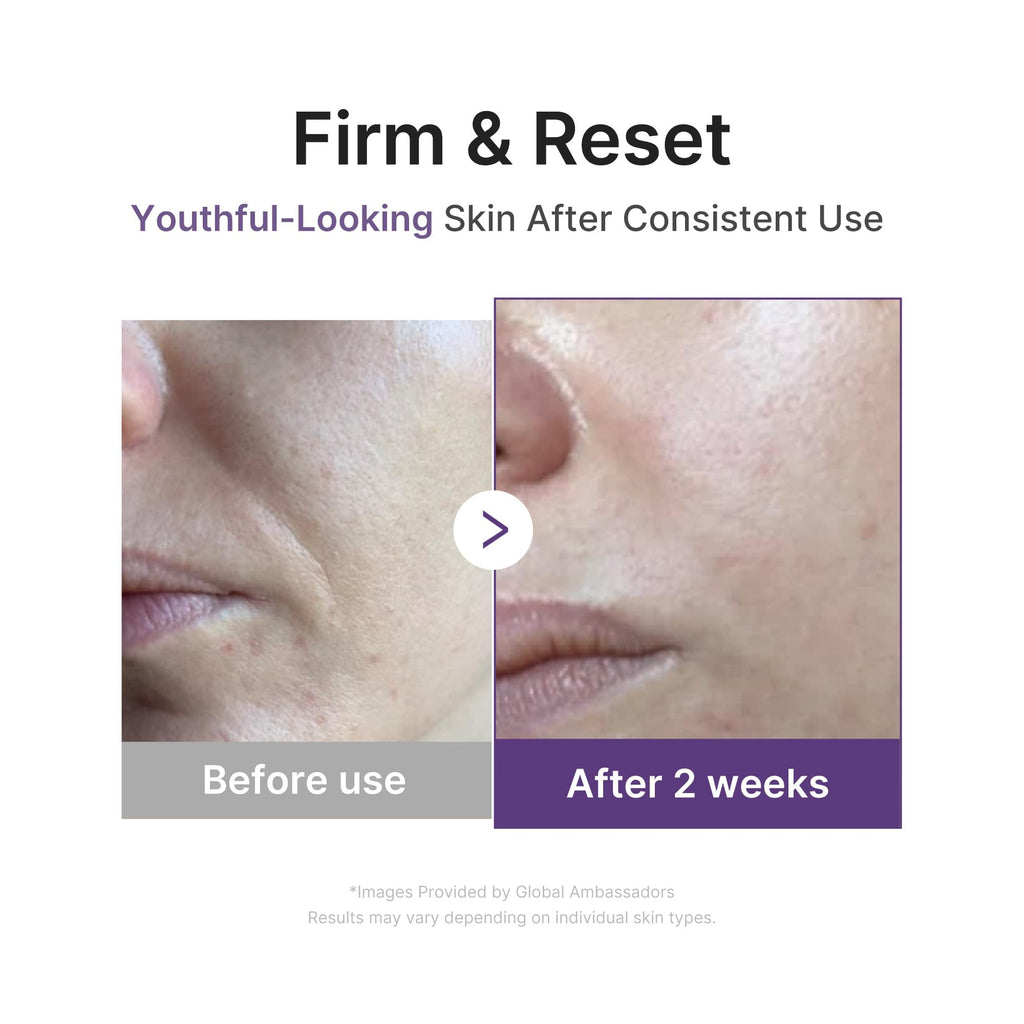 Medicube Retinol Boosting Serum – Intensive Firming, Hydration & Plumping with Retinol, Peptides & Vitamins | Pore Refining & Smooth Radiant Skin | Korean Skincare, 1.01 fl oz