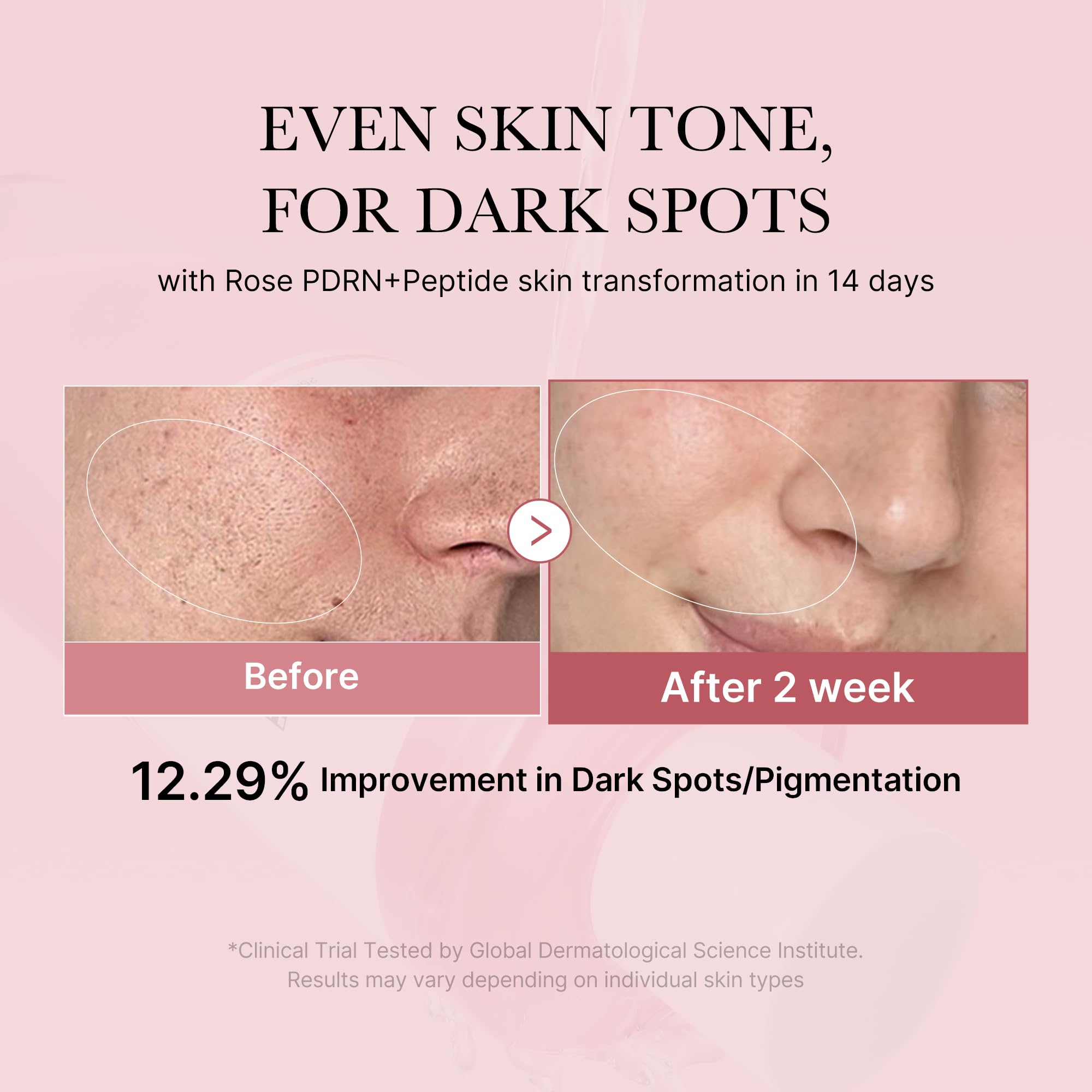 medicube PDRN Toner Rose – Lightweight Rose PDRN Peptide Toner for Radiant, Even Skin Tone | Korean Skincare