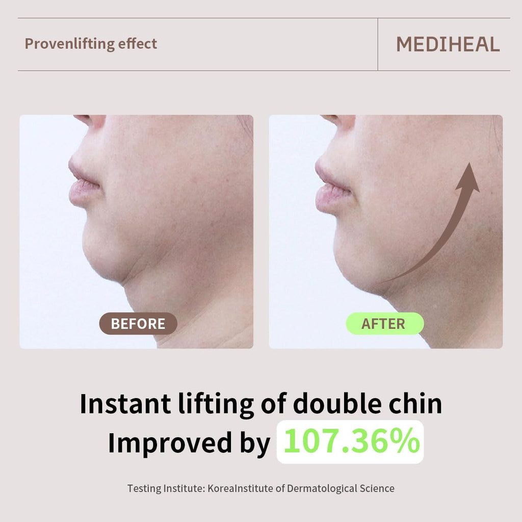 Mediheal Retinol Collagen Cream Lifting Mask – 10 Count | Firming, Anti-Aging Sheet Mask