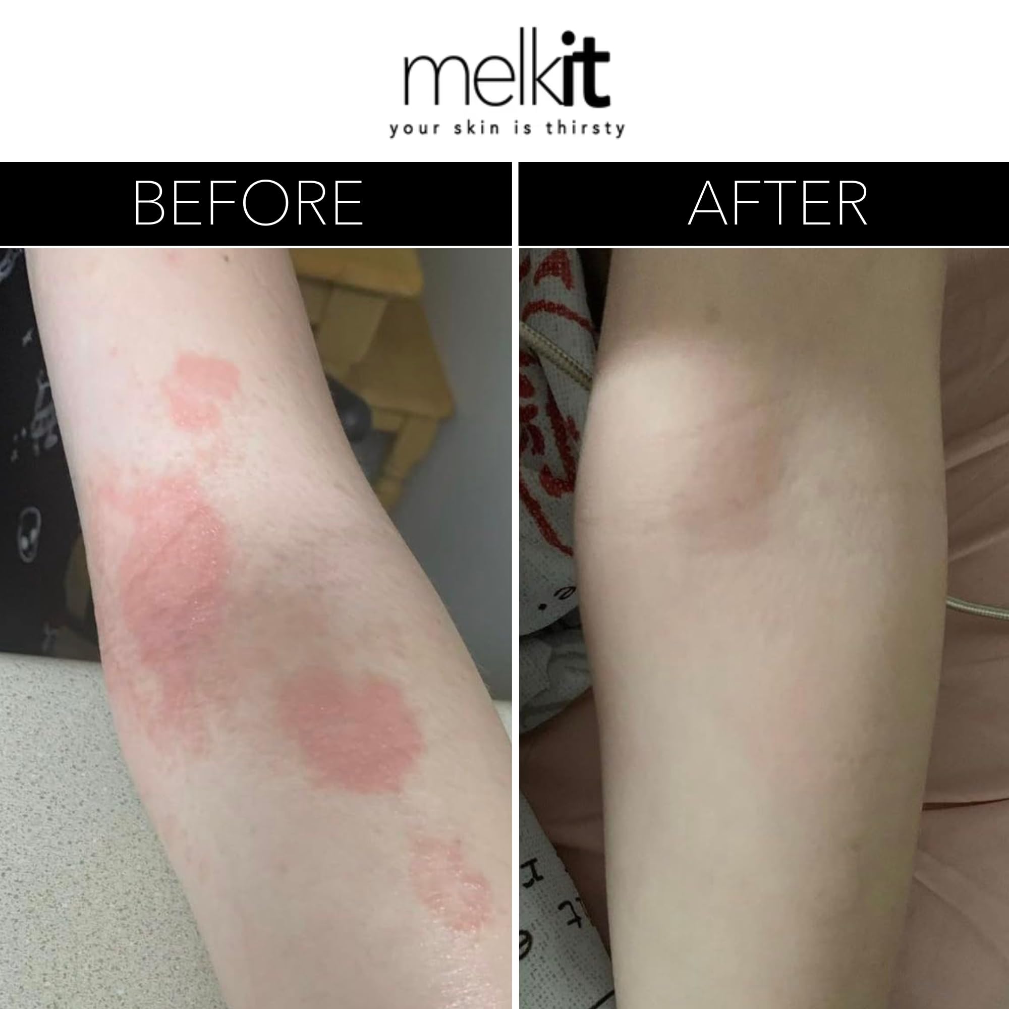 Melkit Body Melk Natural Body Cream – Fast-Absorbing Hydration for Dry & Sensitive Skin (16 oz)