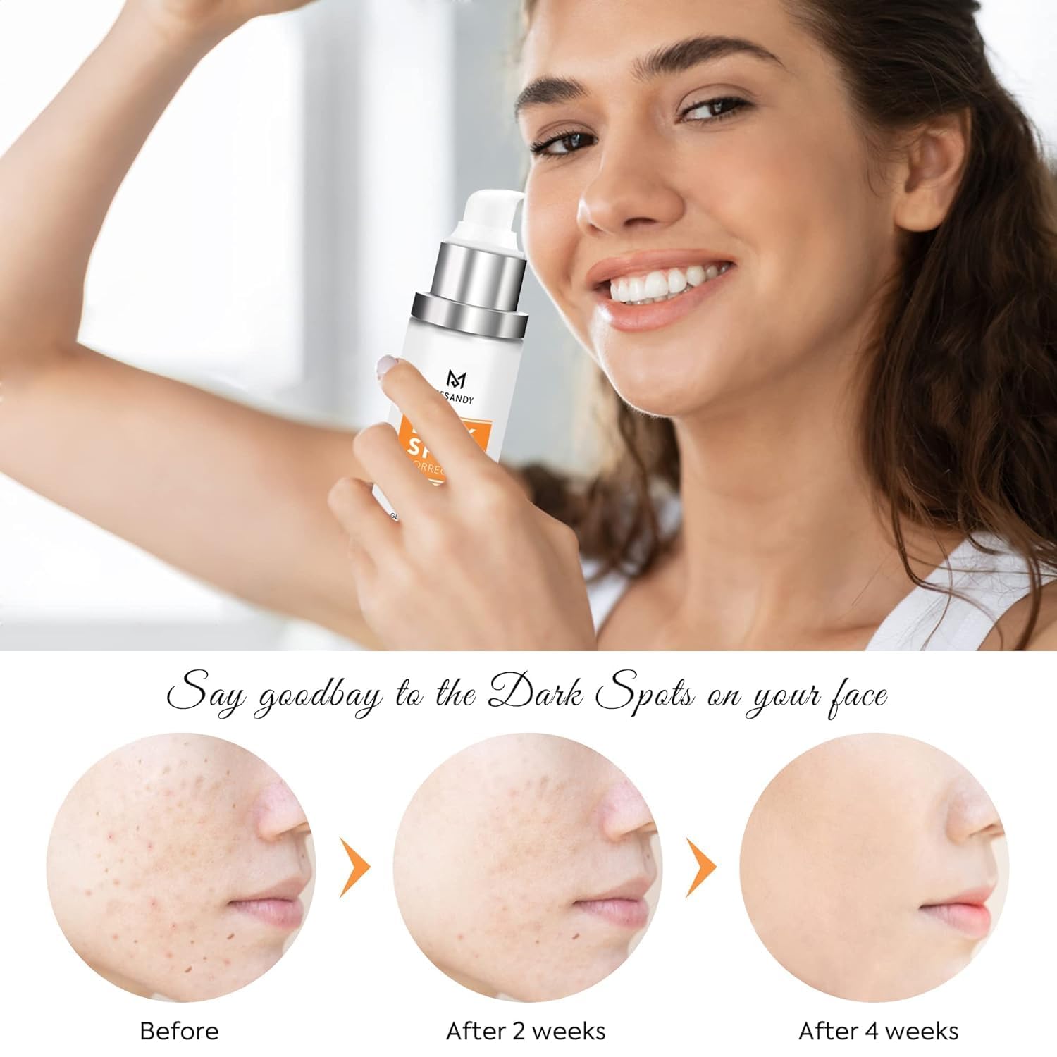 MESANDY Dark Spot Serum for Face – Brighten Sun Spots & Uneven Tone