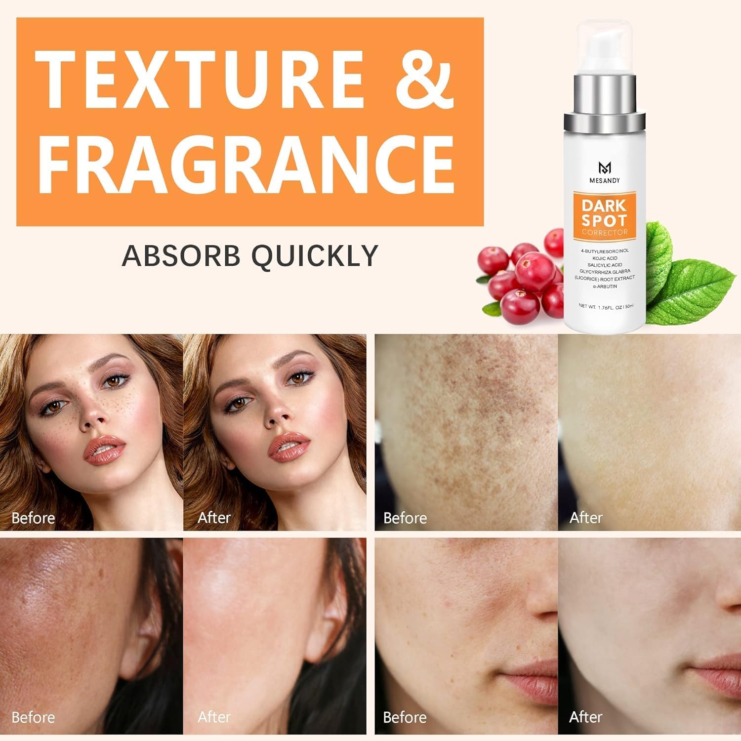 MESANDY Dark Spot Serum for Face – Brighten Sun Spots & Uneven Tone