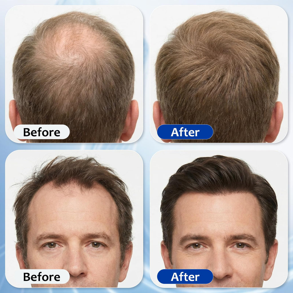 MGVAASURC Hair Growth Serum Roll-On – 3% Rosemary, 3% Batana Oil, 2% Pea Extract, 2% Ginger Root Oil