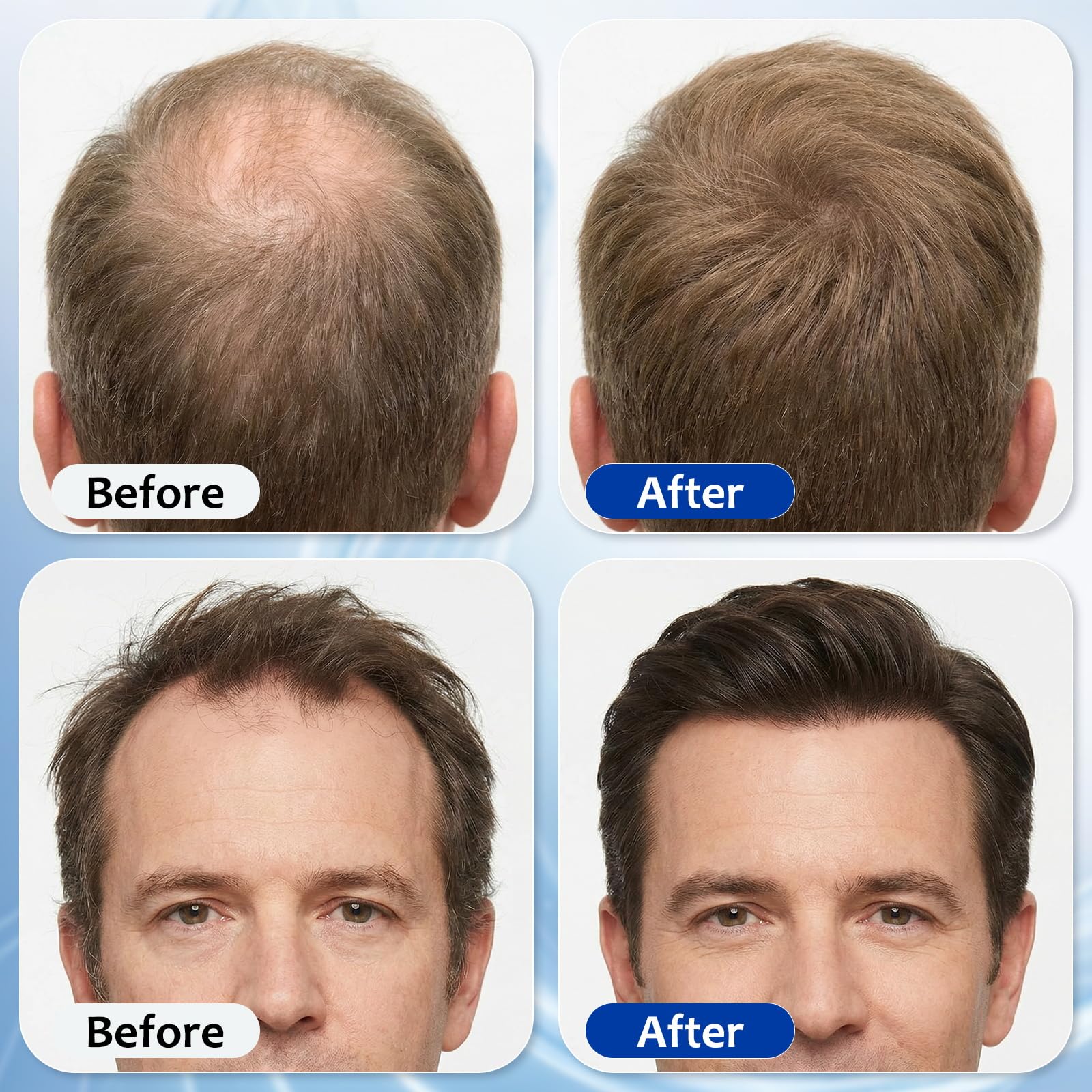 MGVAASURC Hair Growth Serum Roll-On – 3% Rosemary, 3% Batana Oil, 2% Pea Extract, 2% Ginger Root Oil