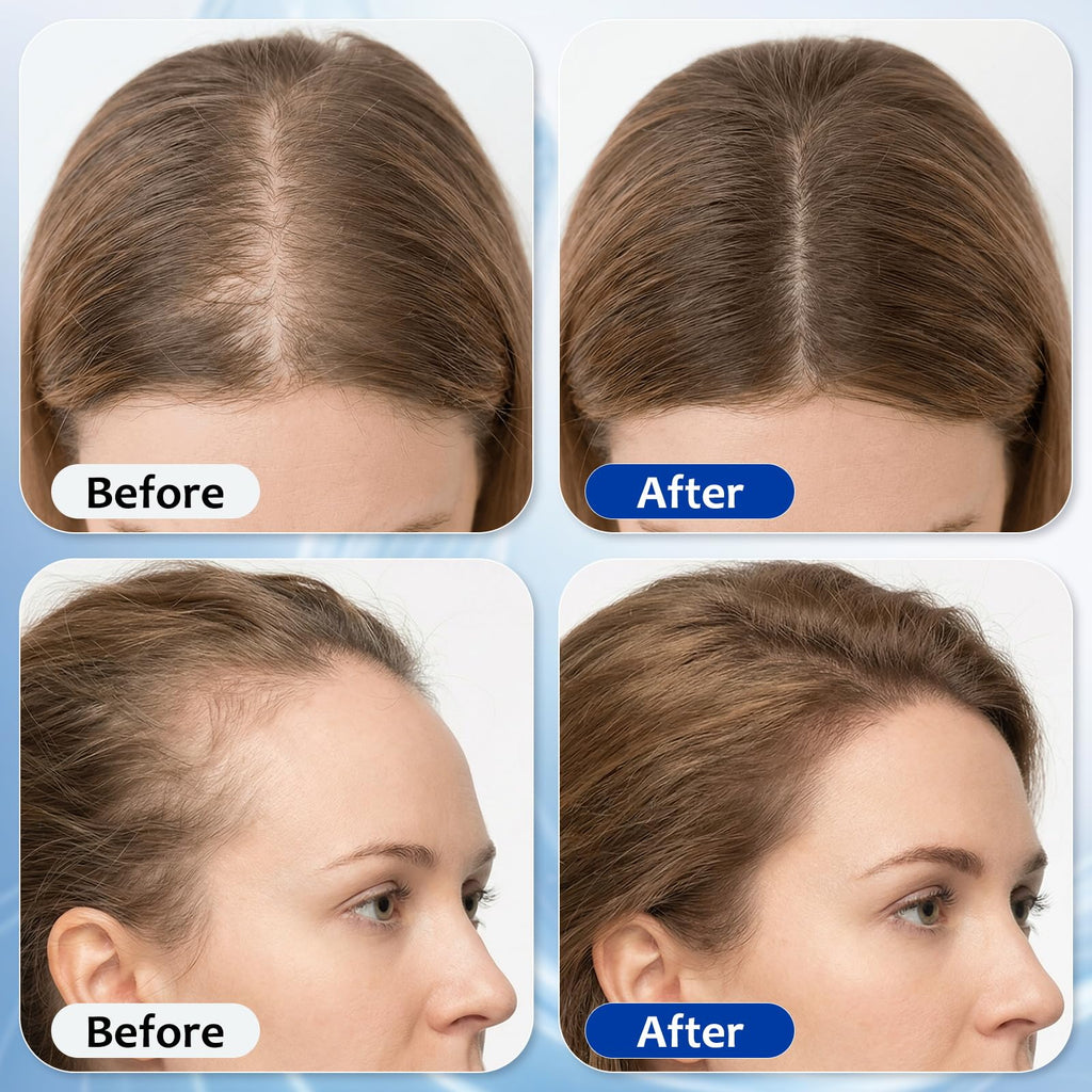 MGVAASURC Hair Growth Serum Roll-On – 3% Rosemary, 3% Batana Oil, 2% Pea Extract, 2% Ginger Root Oil