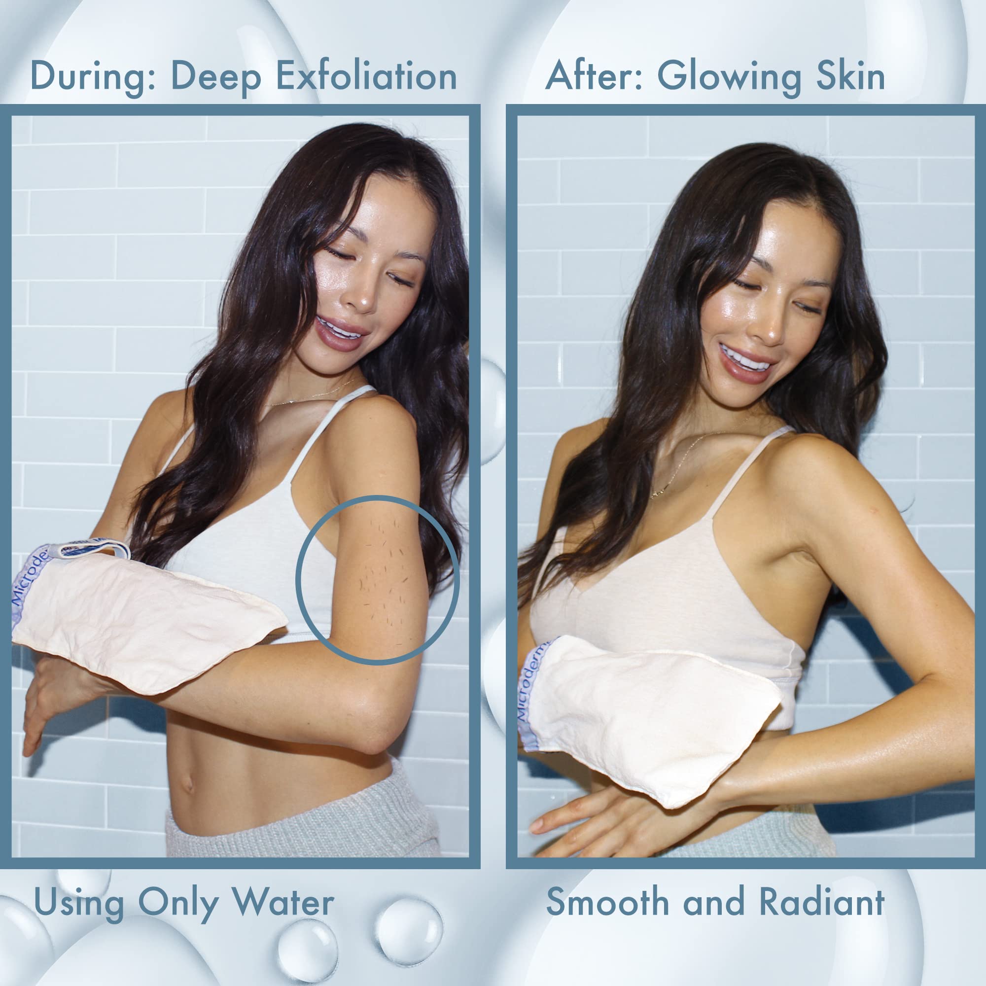 MicrodermaMitt Original Deep Exfoliating Mitt for Body | Premium Turkish Kessa Glove