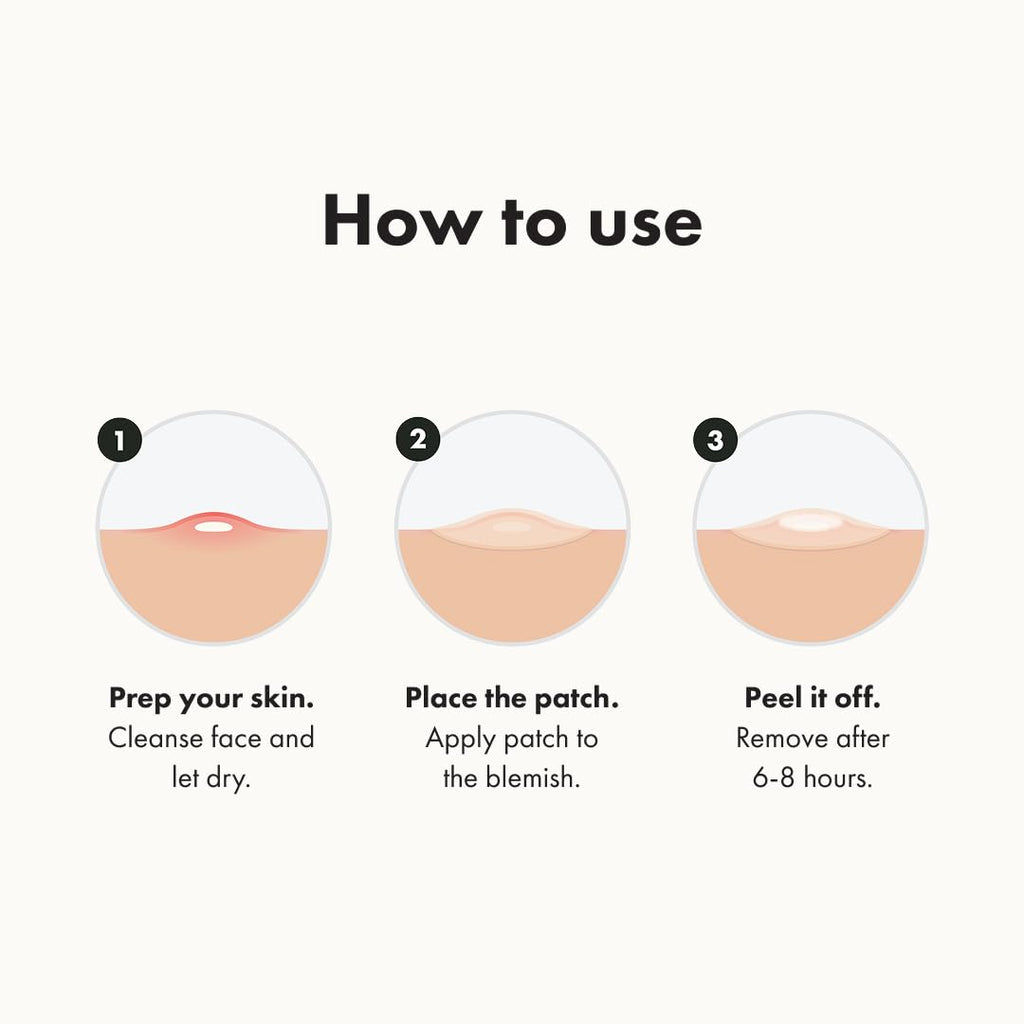 Mighty Patch Original Patch by Hero Cosmetics – #1 Acne Patch (36 Count)