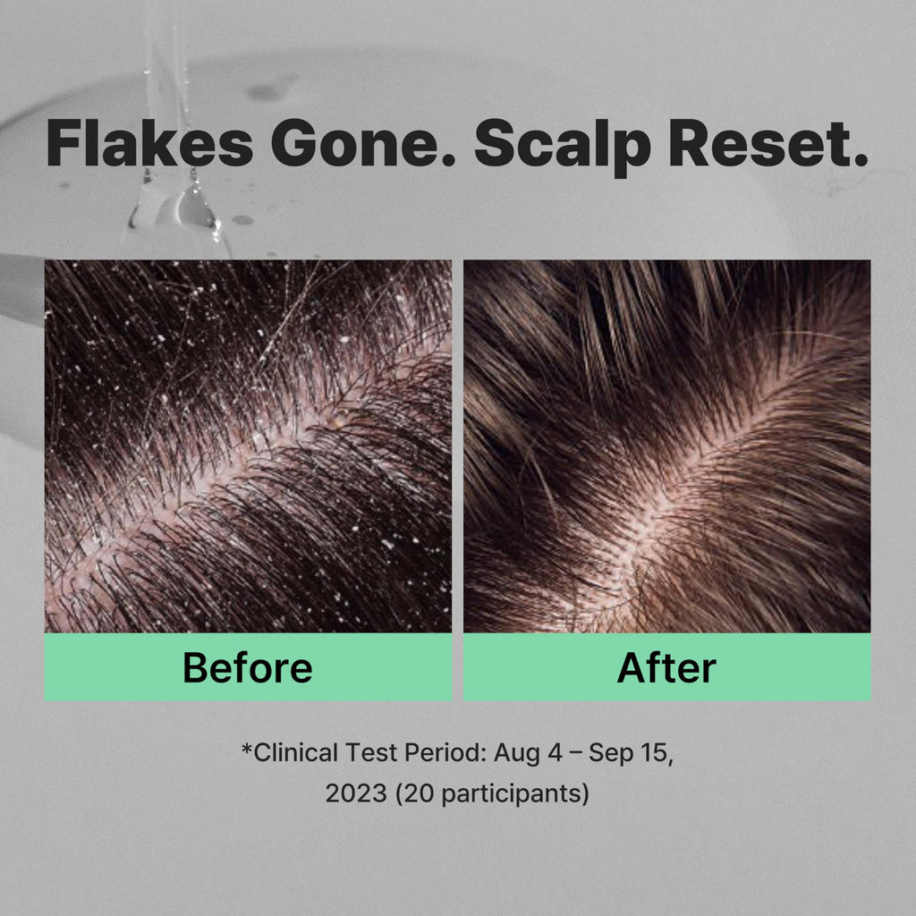 MINOXELL Korean Oil Control Shampoo | Clarifying Scalp Care for Oily Roots