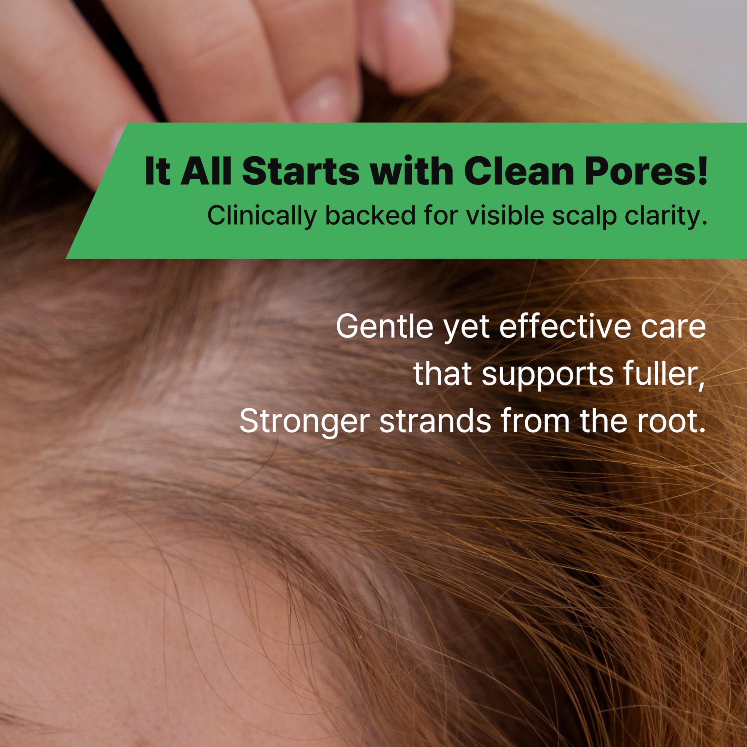 MINOXELL Korean Oil Control Shampoo | Clarifying Scalp Care for Oily Roots