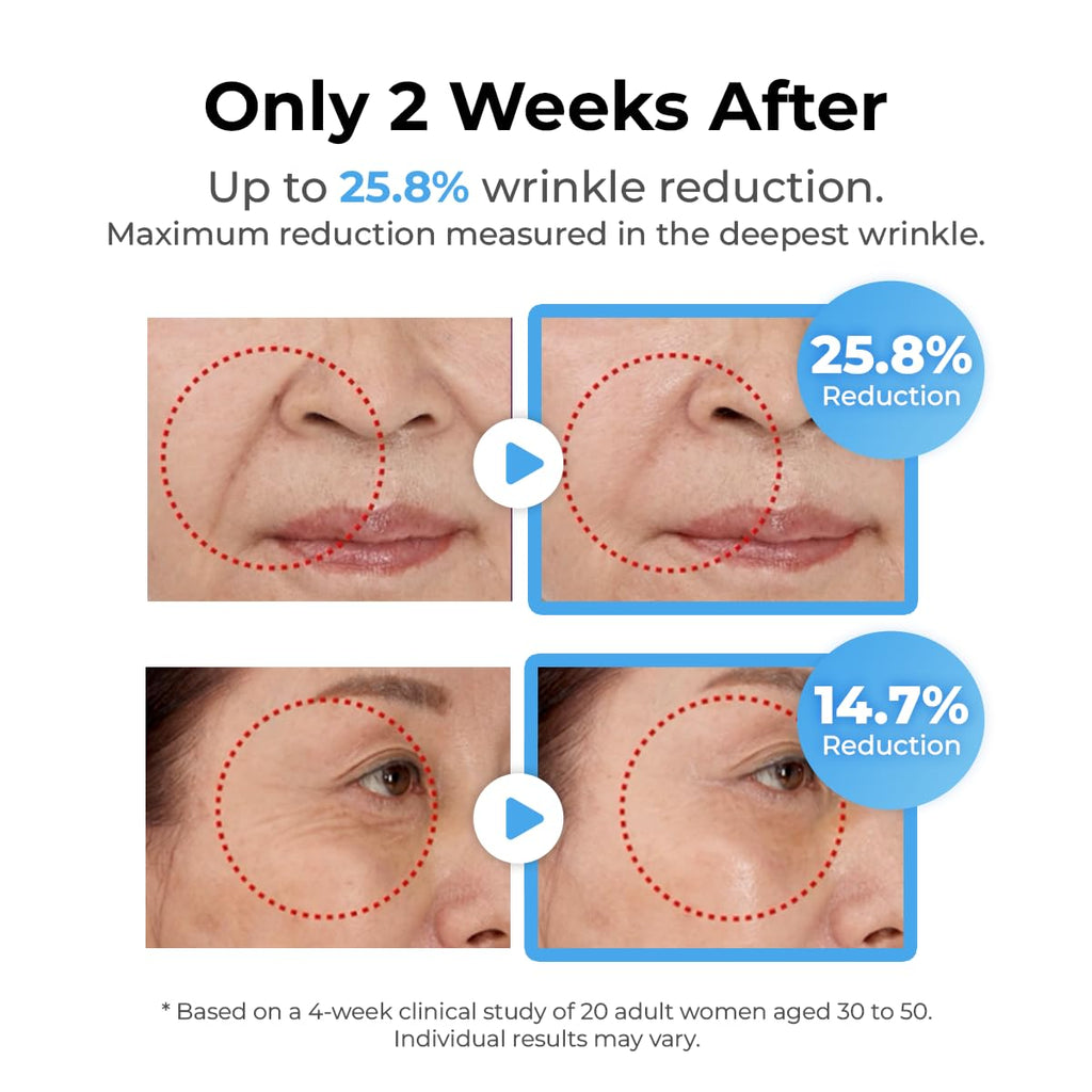 MISS MYER SNOW TOX WrinkleTreatment Serum – Instant Botox-Like Lift, Needle-Free Wrinkle Reduction, 30 ml