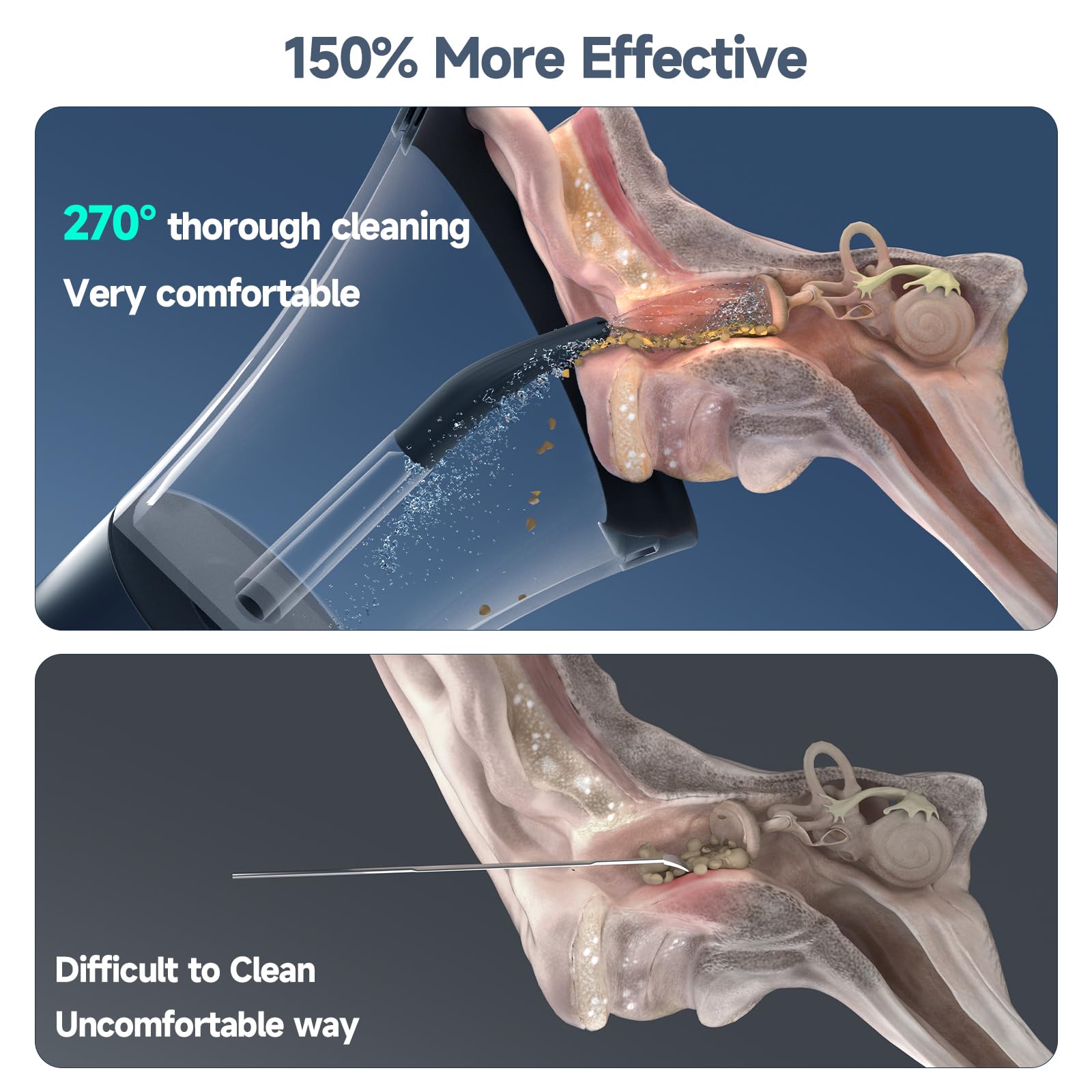 Morfone Electric Ear Cleaning Kit – 4-Mode Safe Ear Wax Removal System
