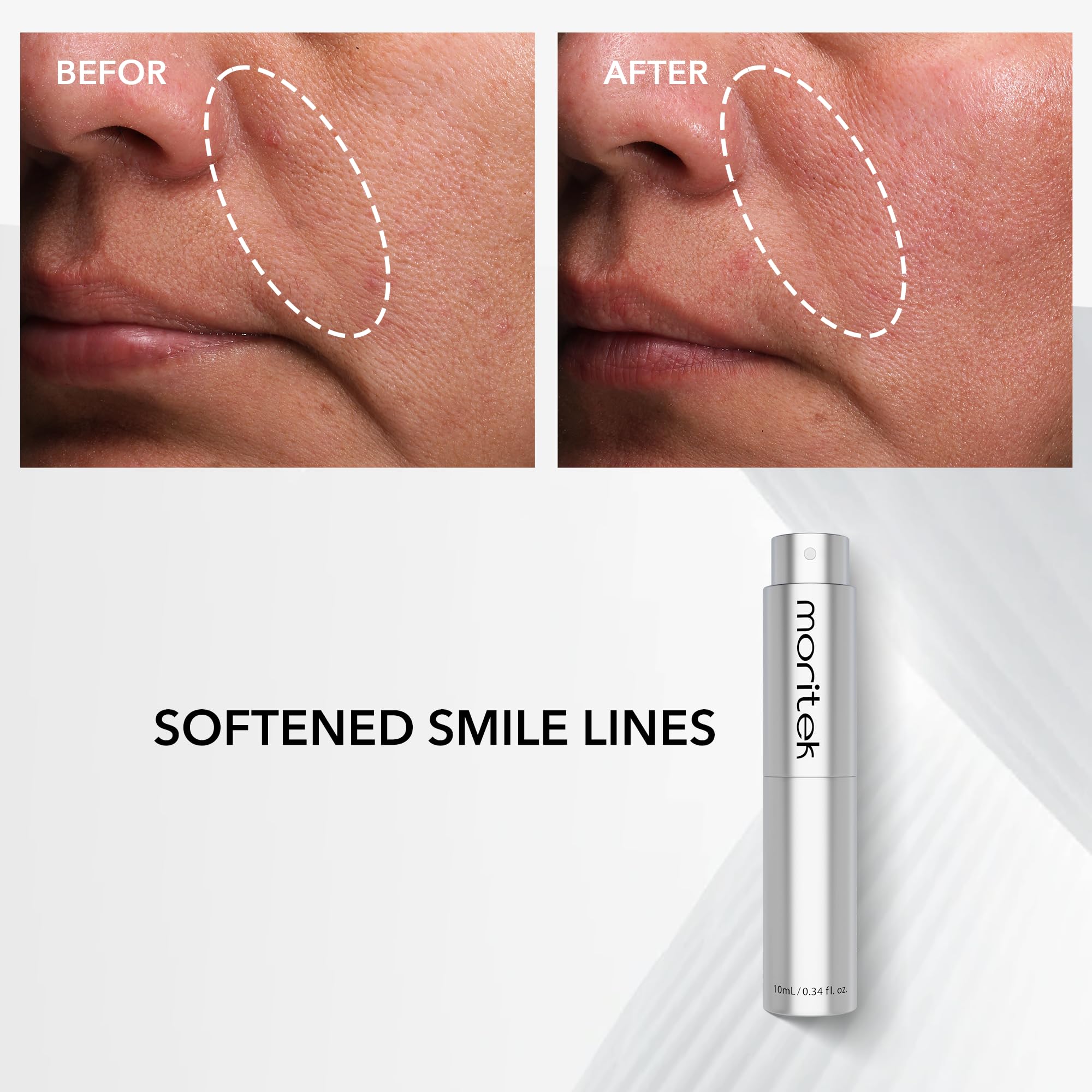 MORITEK Anti-Wrinkle & Lifting Essence Mist for Sensitive Skin – Hydrate, Firm, Brighten (10ml)