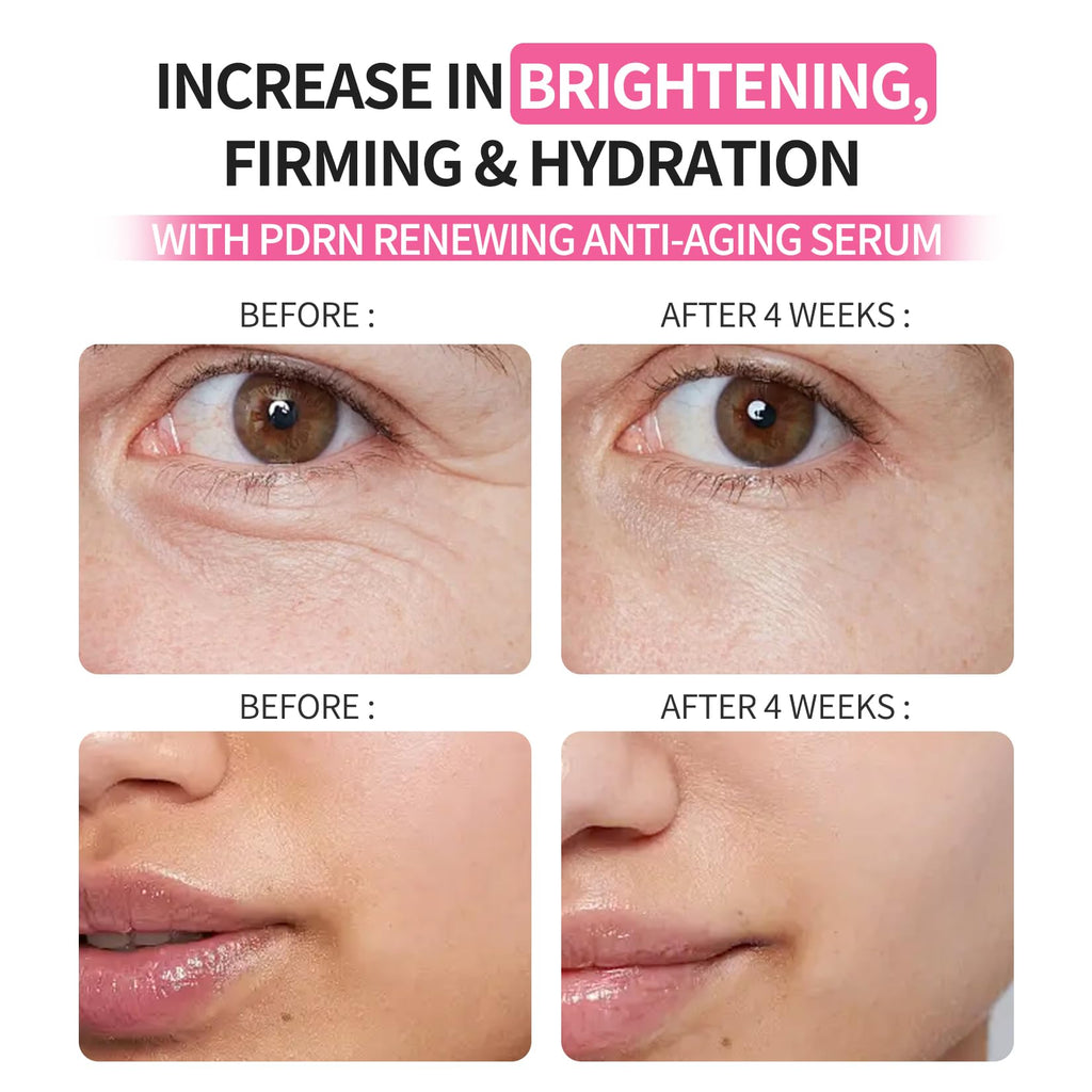 Morovan Salmon DNA Firming Serum – 99% PDRN Triple Concentrate for Wrinkles
