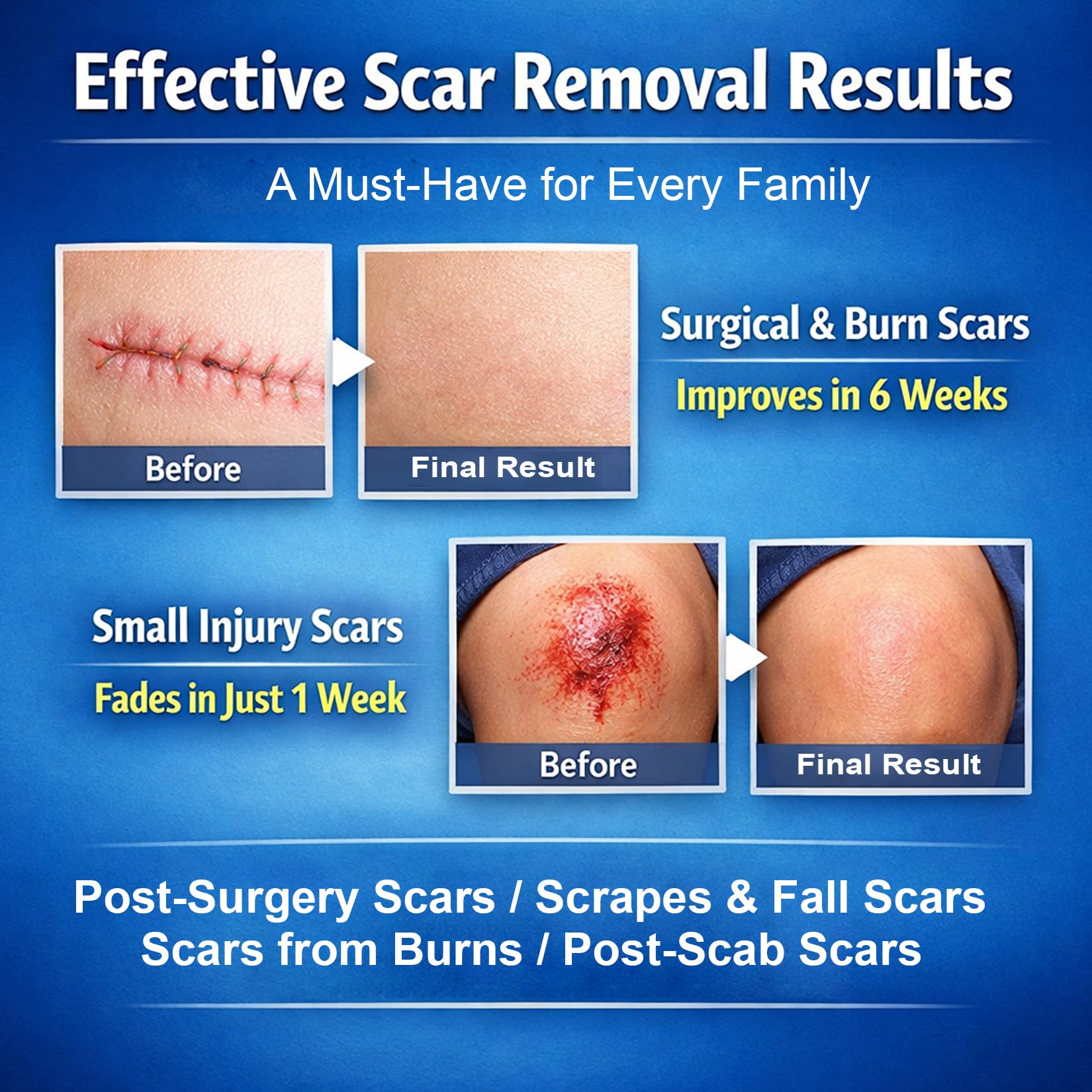 Morovan Silicone Scar Removal Gel | Minimize Visible Scars on Face & Body in as Little as 6 Weeks
