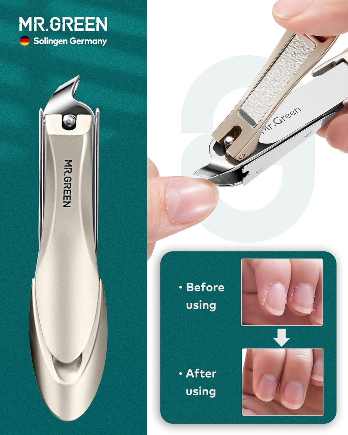 MR.GREEN 8-in-1 Manicure Set – German Stainless Steel Nail Care Kit with Splash-Proof Clippers