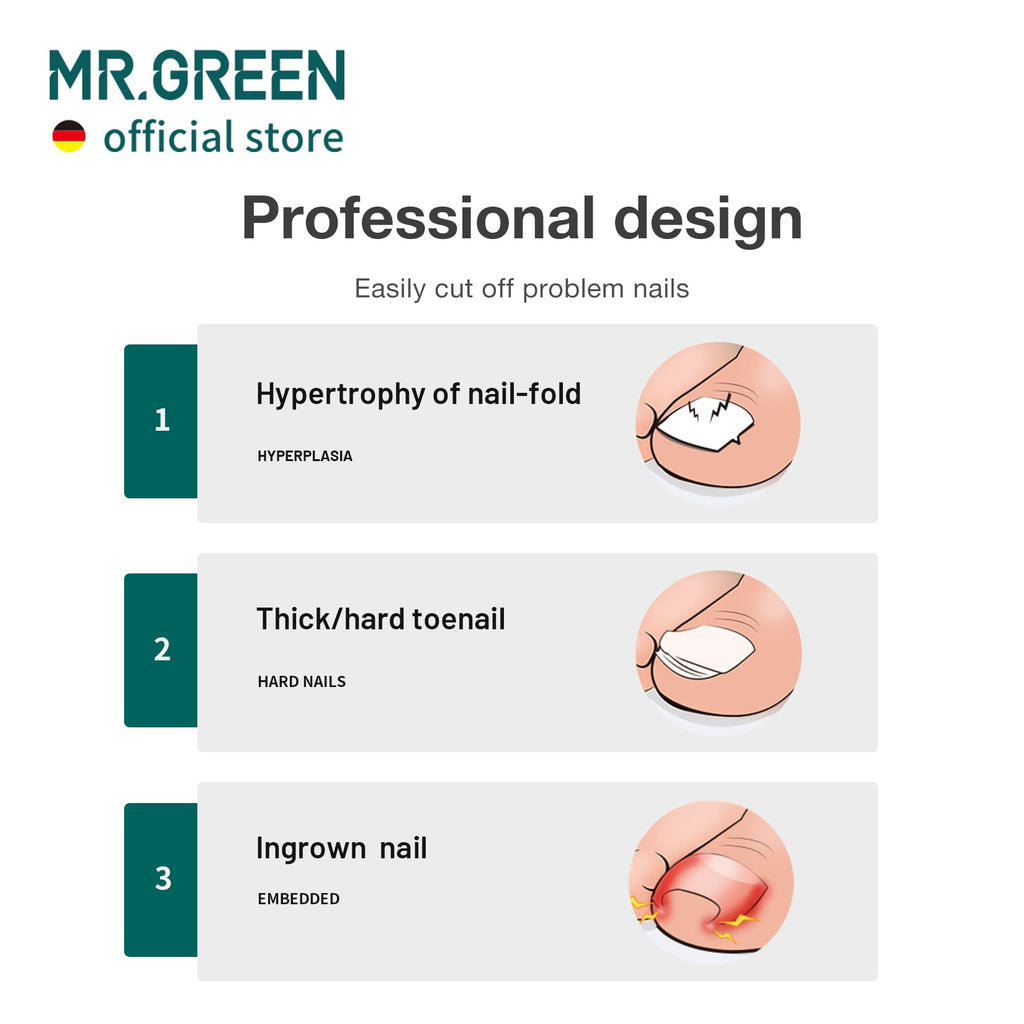 MR.GREEN Toenail Clippers Stainless Steel – Ingrown, Thick & Hard Nails Pedicure Tools (Orange + Nail Remover)