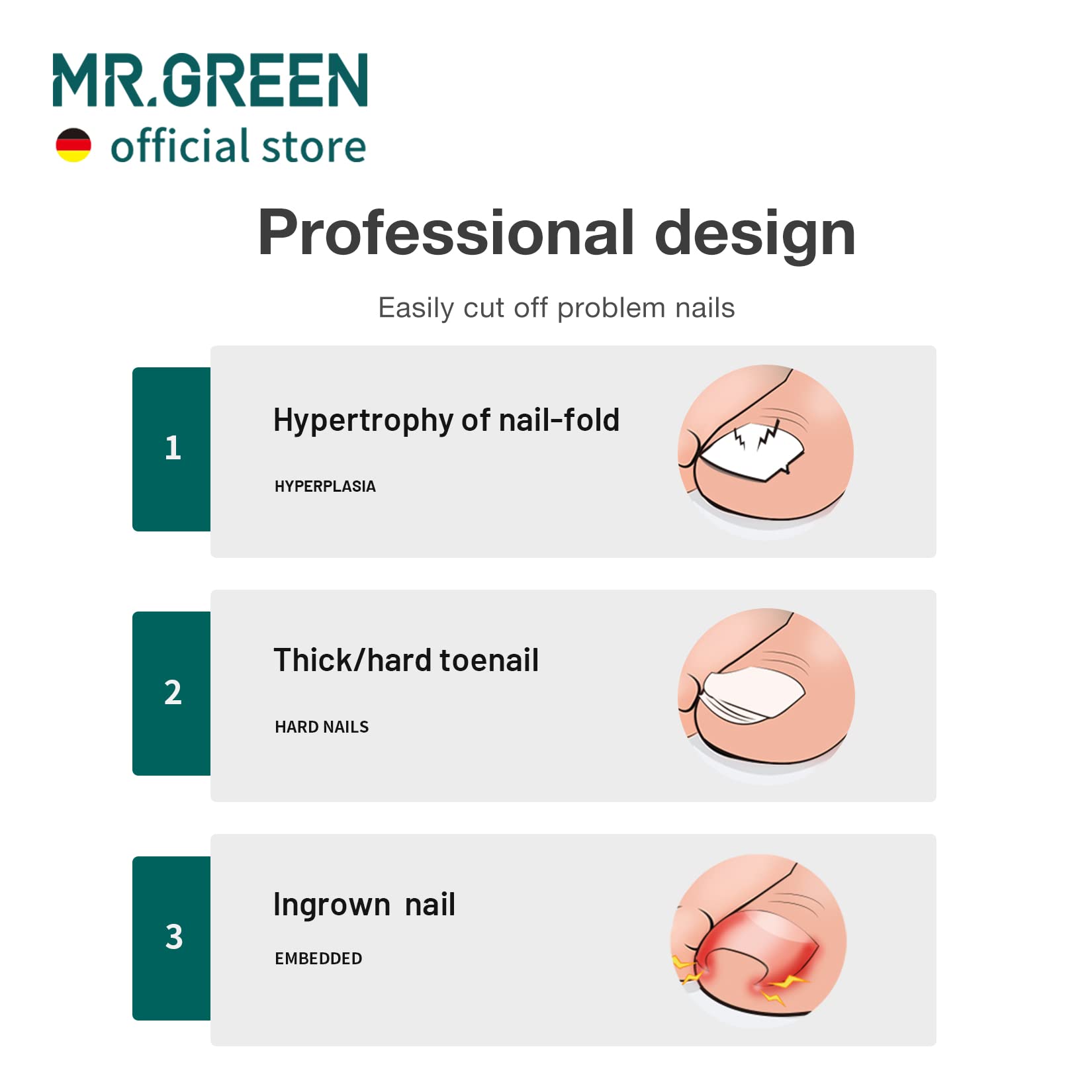 MR.GREEN Toenail Clippers Stainless Steel – Ingrown, Thick & Hard Nails Pedicure Tools (Orange + Nail Remover)