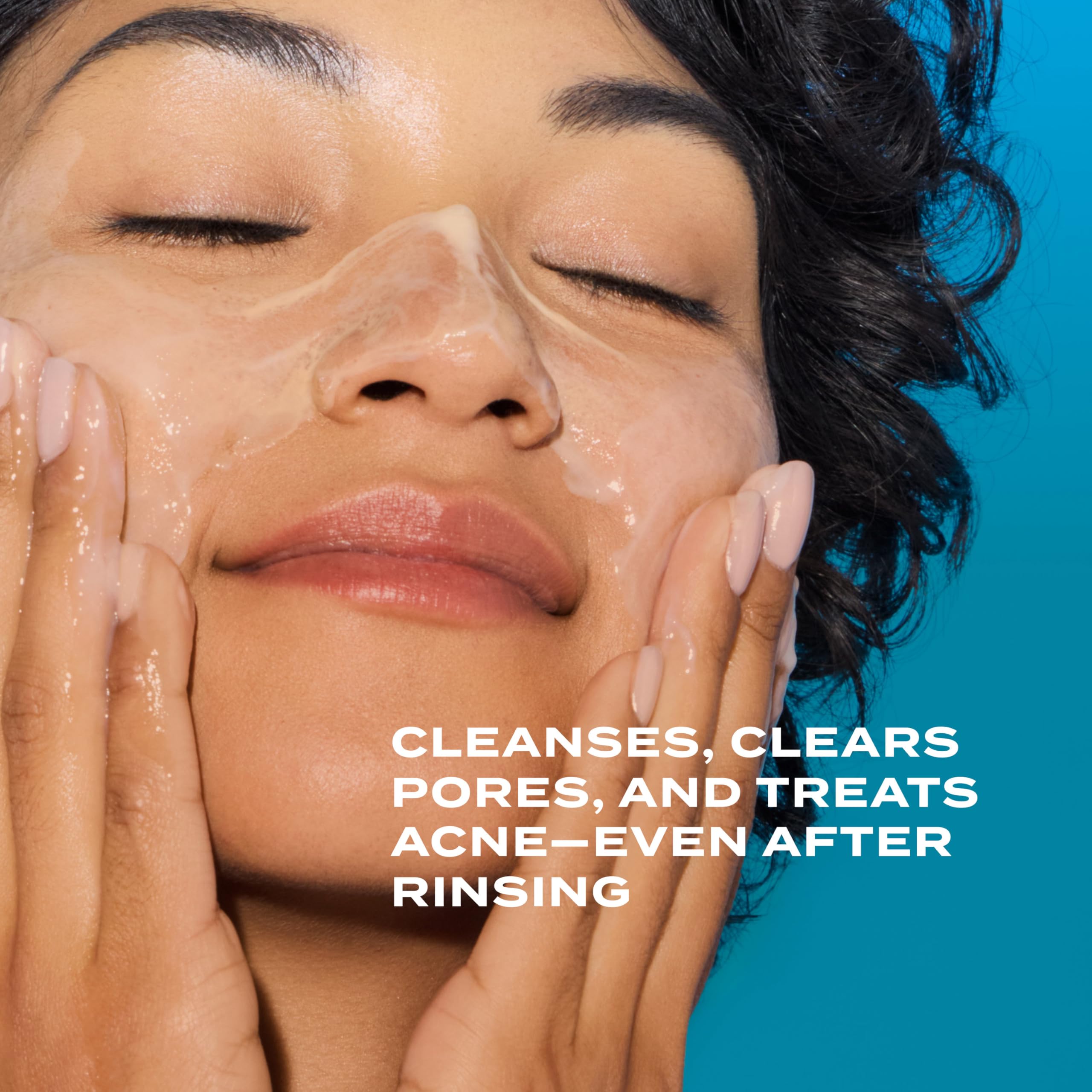 Murad Acne Control Clarifying Cleanser – Salicylic Acid & Green Tea for Oil Control (5 oz)