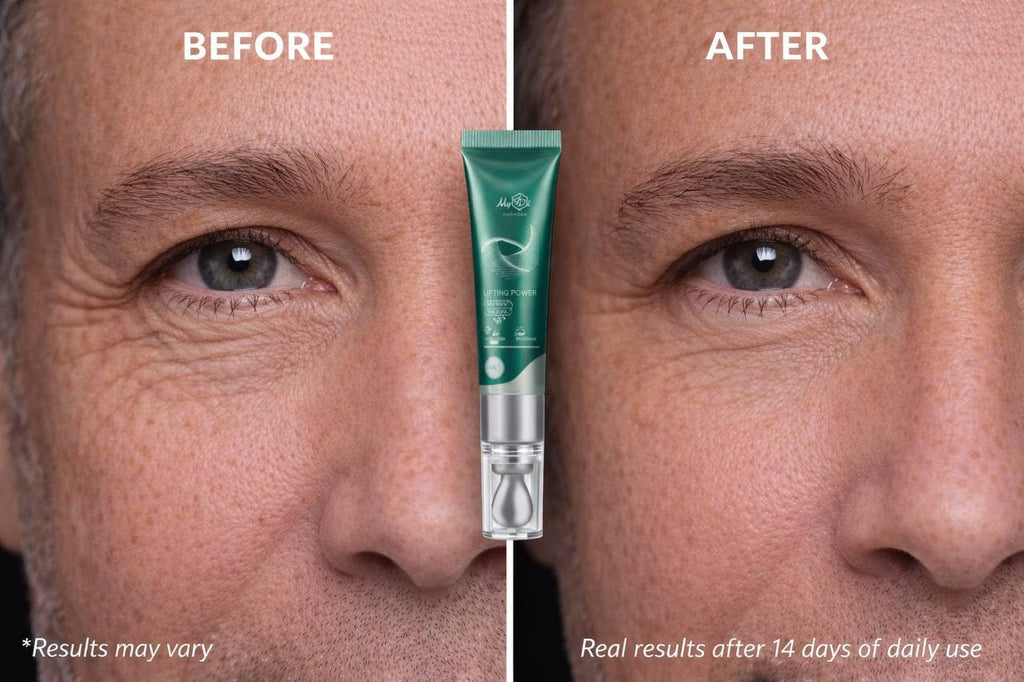 MyIDi Lifting Power Eye Fluid – Hydrating Anti-Aging Serum