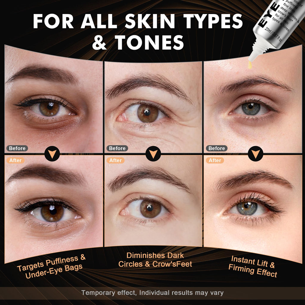Nabevin KKP Perfection Eye Tightener with Brush – Instant Firming Formula | Portable 0.71 fl oz