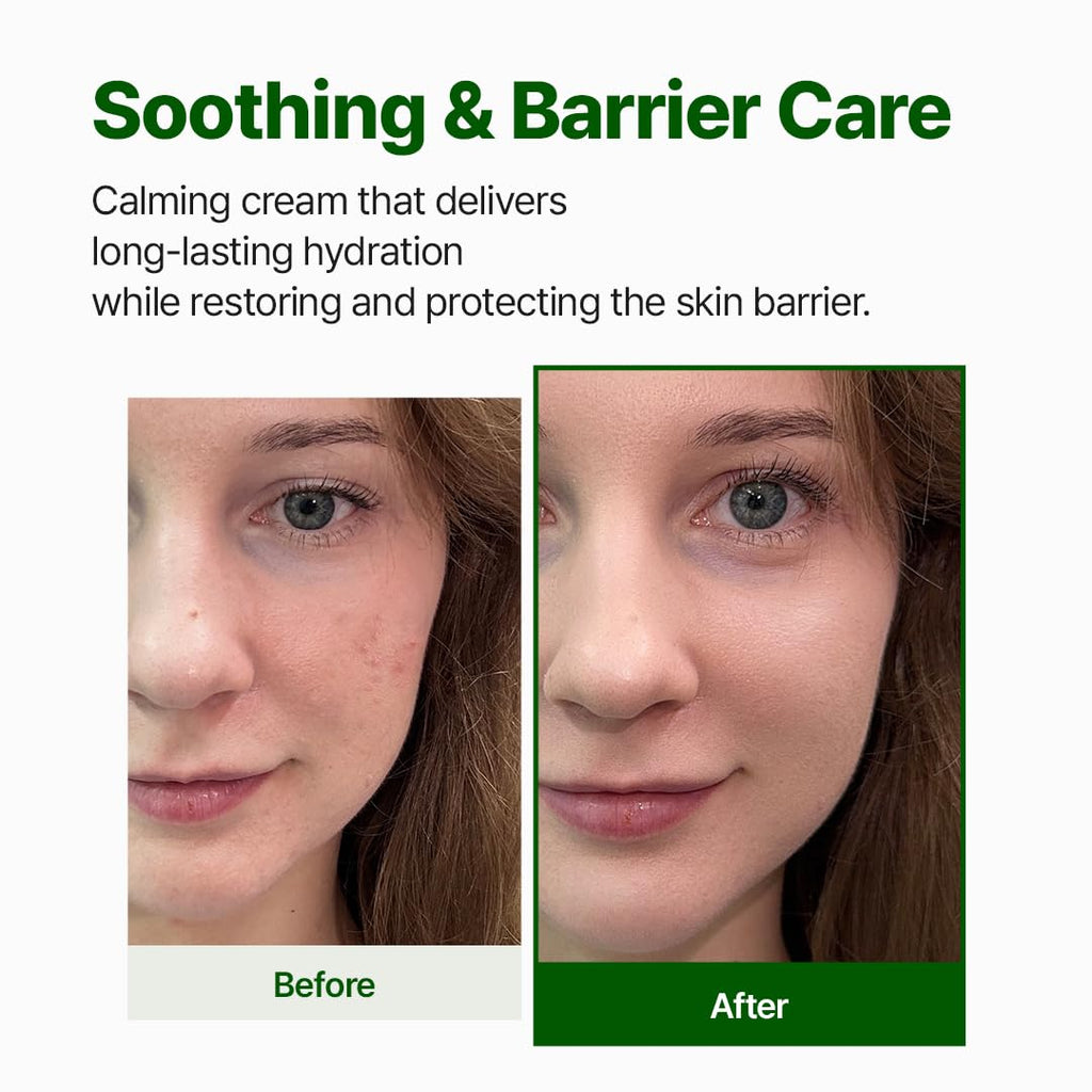 NACIFIC Cica PDRN Barrier Repair Cream – 76% Centella, Deep Hydration