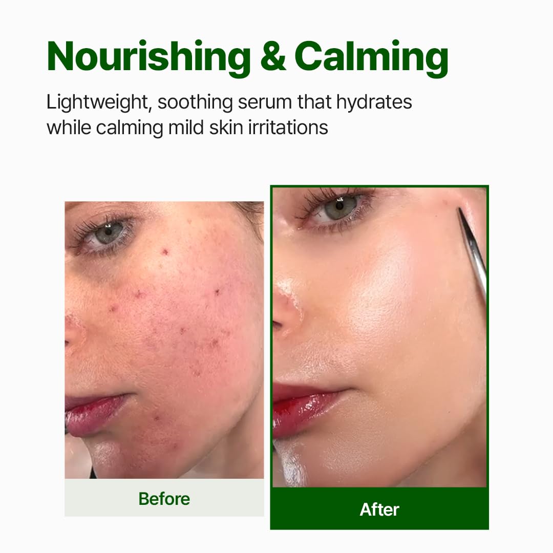 NACIFIC Cica PDRN Centella Serum – Calming, Hydrating Centella Ampoule for Sensitive Skin (50ml)