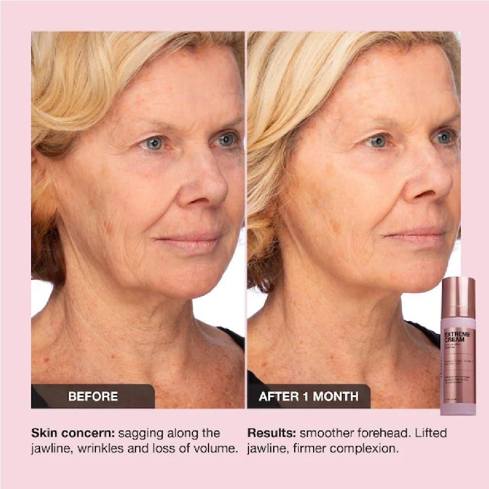 NAPH iNNBEAUTY PROJECT Extreme Cream – Anti-Aging, Firming & Refillable Moisturizer (+ Acne Patch Bonus)