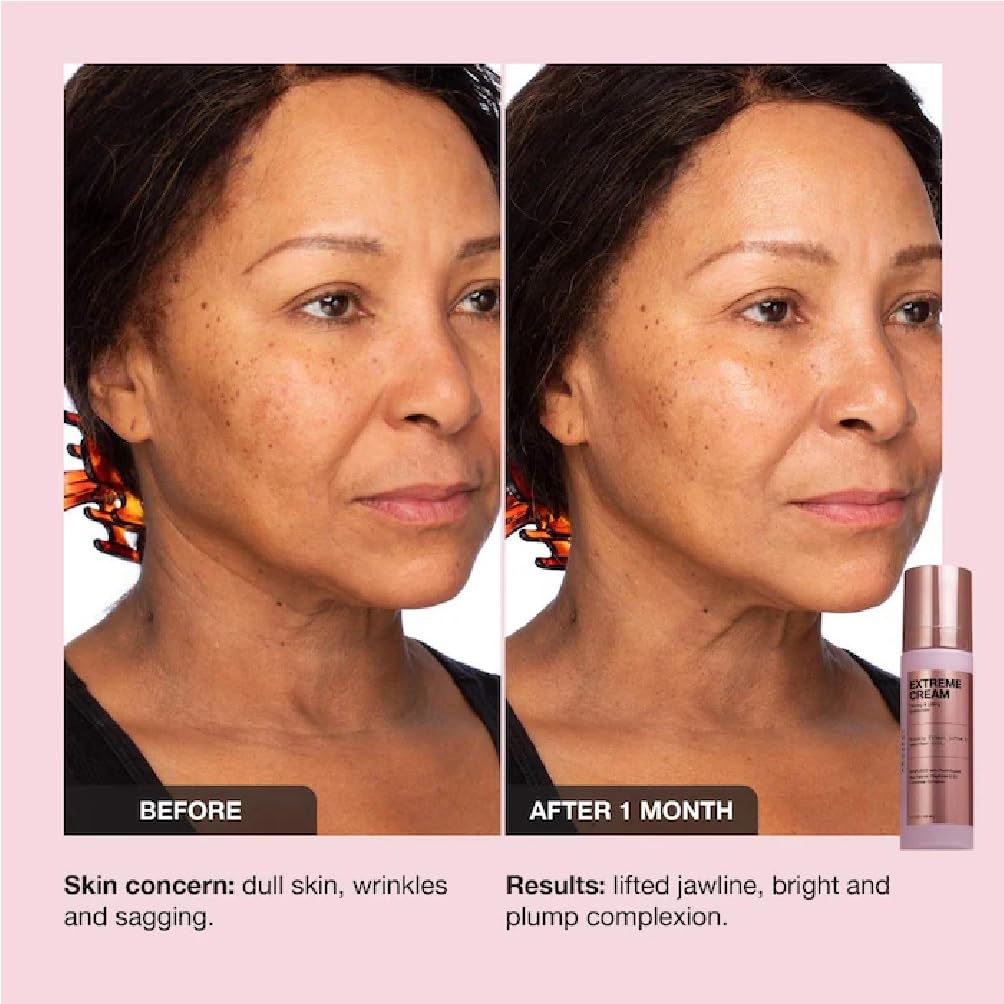 NAPH iNNBEAUTY PROJECT Extreme Cream – Anti-Aging, Firming & Refillable Moisturizer (+ Acne Patch Bonus)