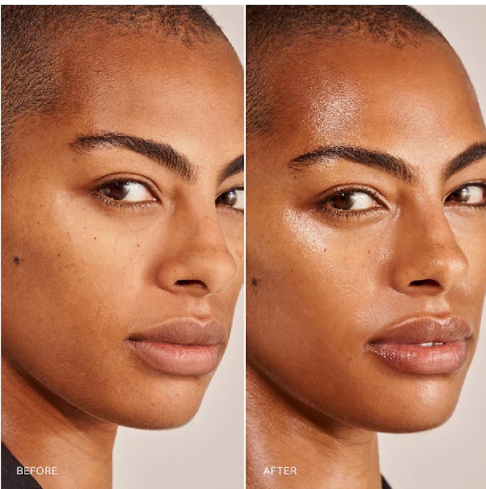 NAPH M Great Skin Instant Glow Serum with Niacinamide & Hyaluronic Acid (50 ml) + Bonus Acne Patch & Tea Tree Water Gel