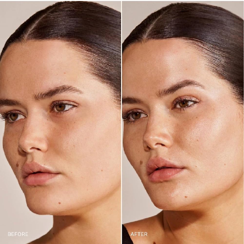 NAPH M Great Skin Instant Glow Serum with Niacinamide & Hyaluronic Acid (50 ml) + Bonus Acne Patch & Tea Tree Water Gel