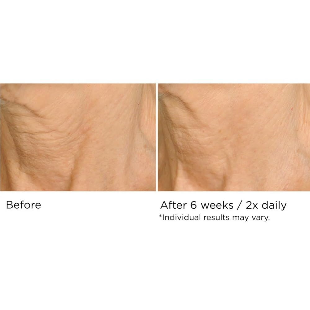 NassifMD Deco-Lift Neck Firming Complex Serum | Hydration & Smoothing